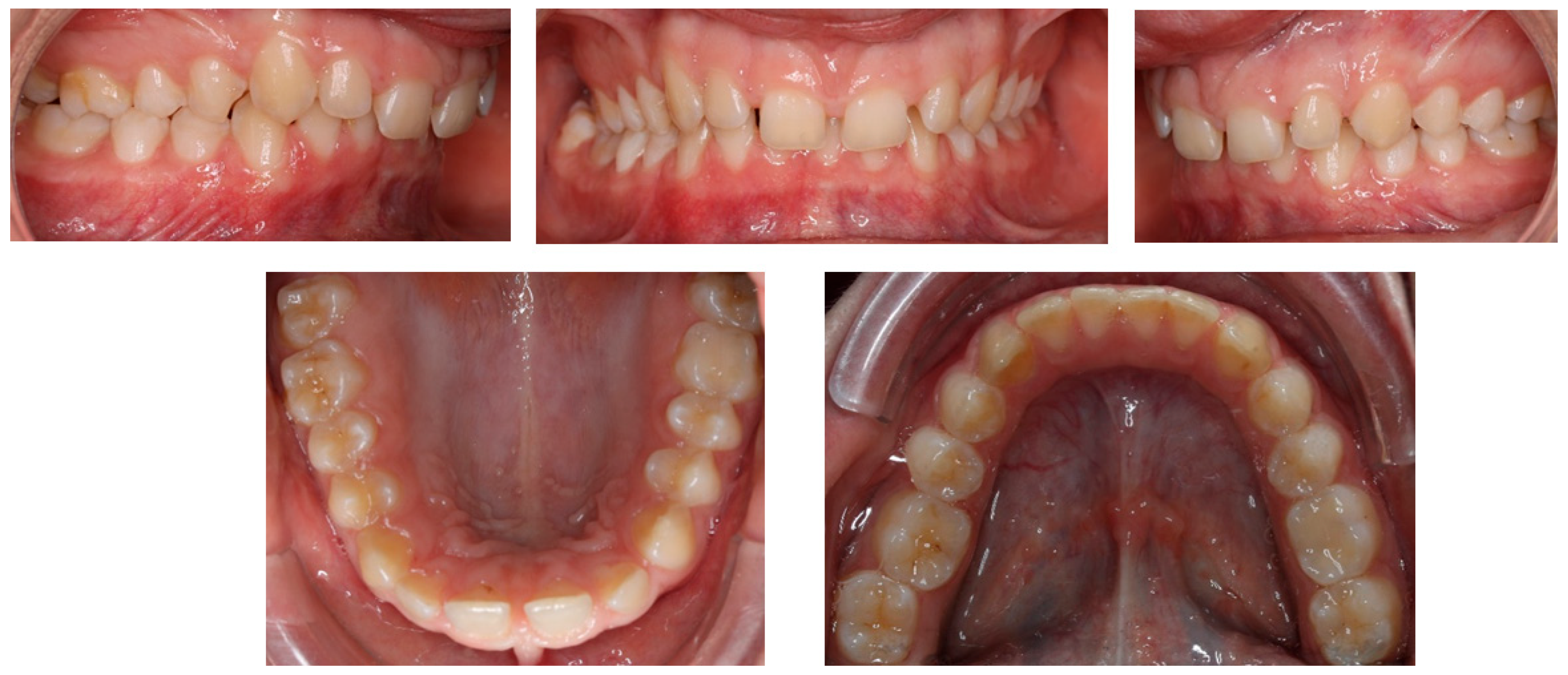 Children 11 00358 g002