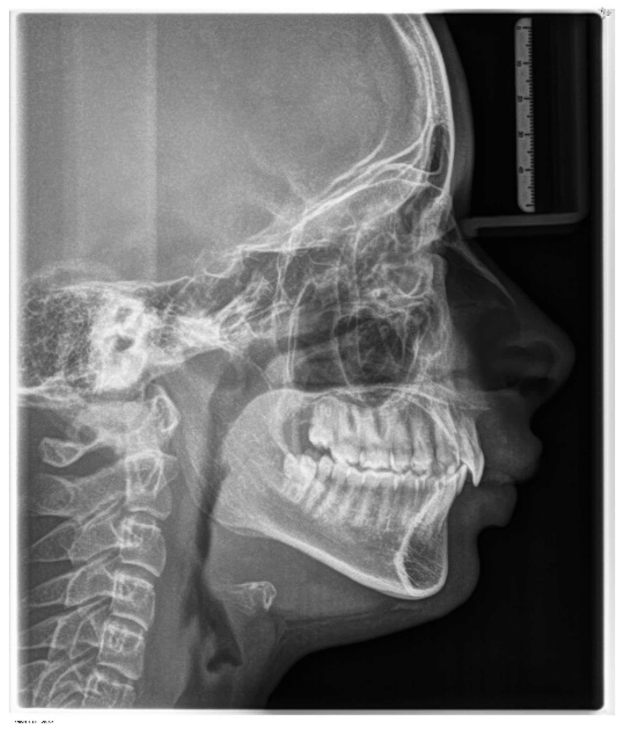 Children 11 00358 g004