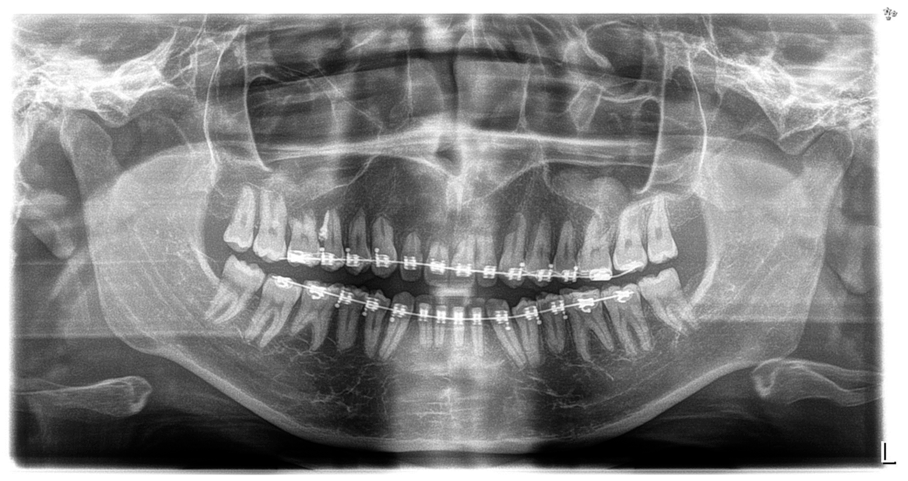 Children 11 00358 g005