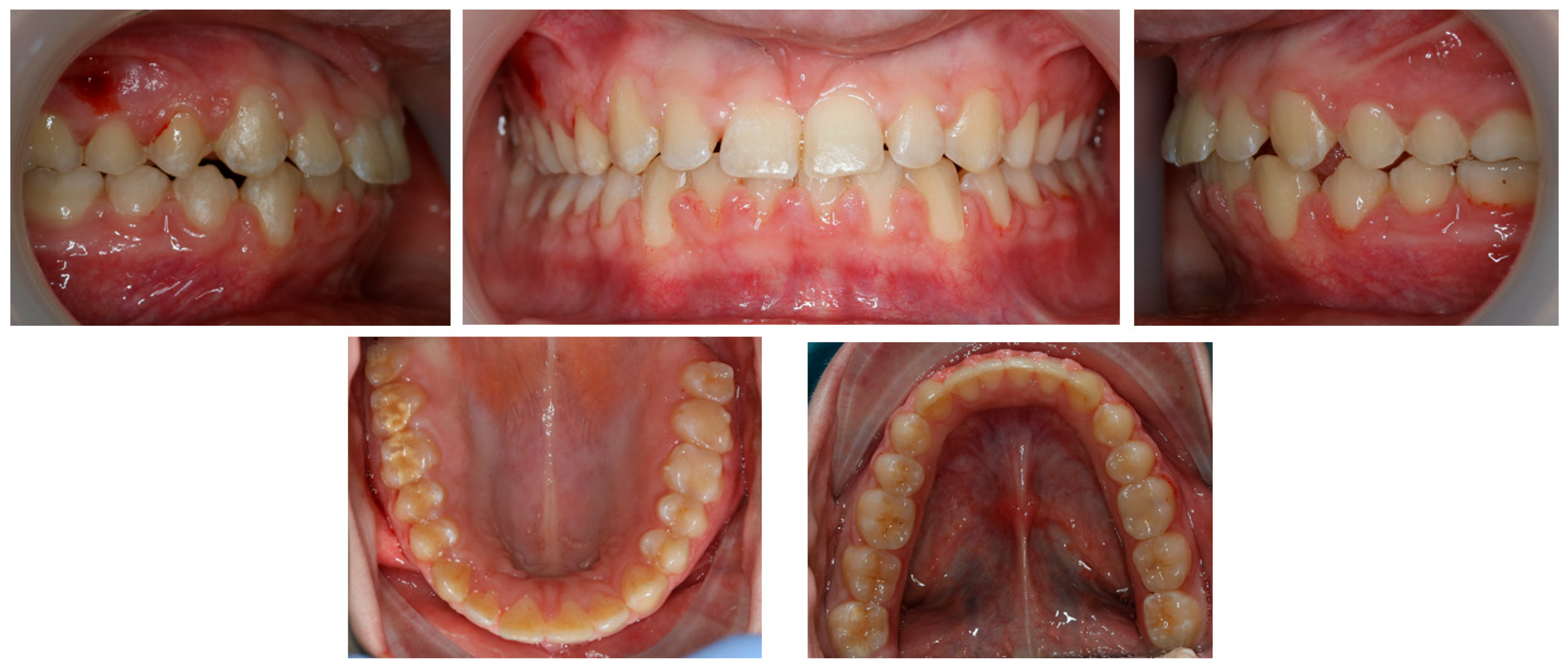 Children 11 00358 g006