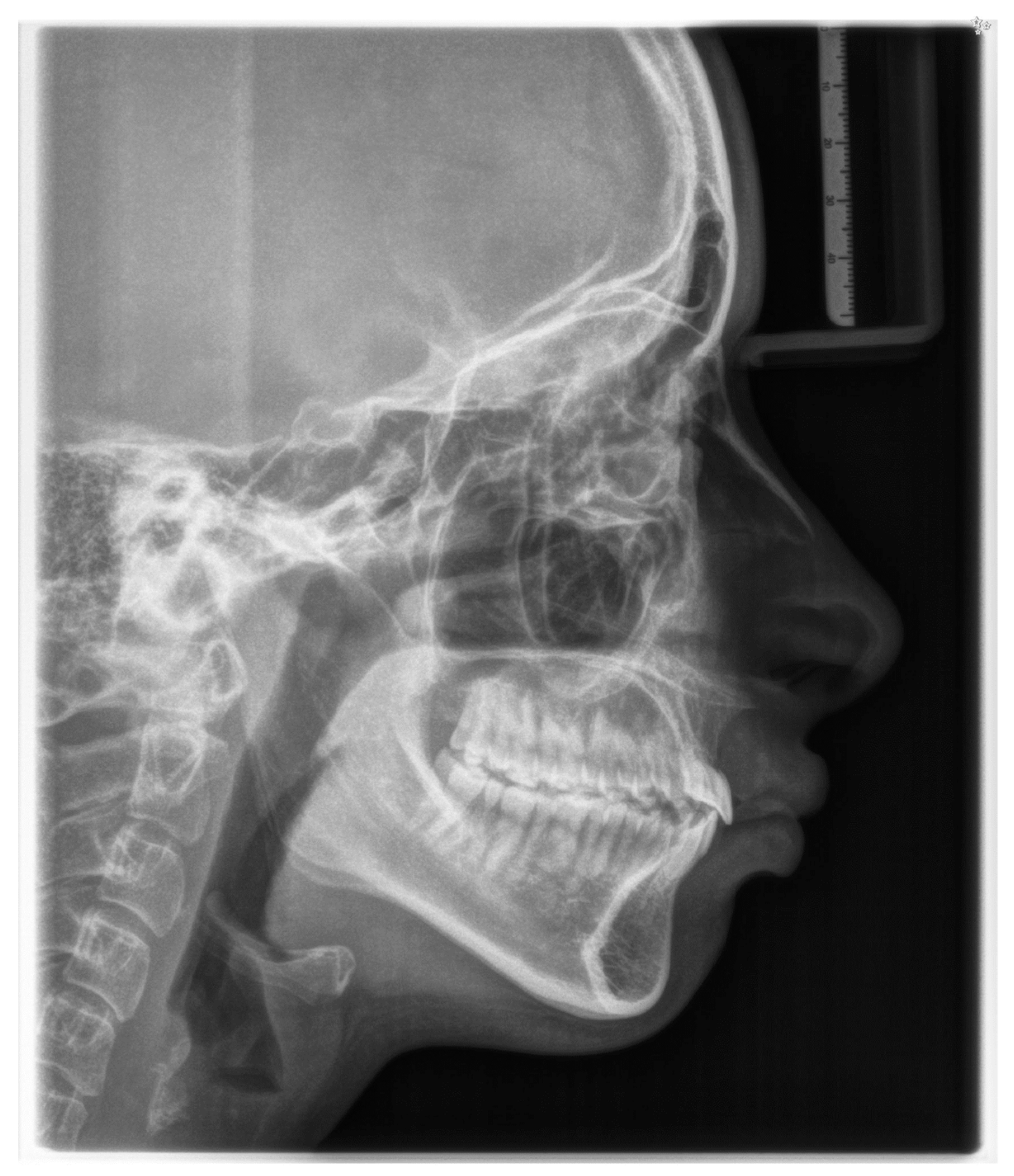 Children 11 00358 g007