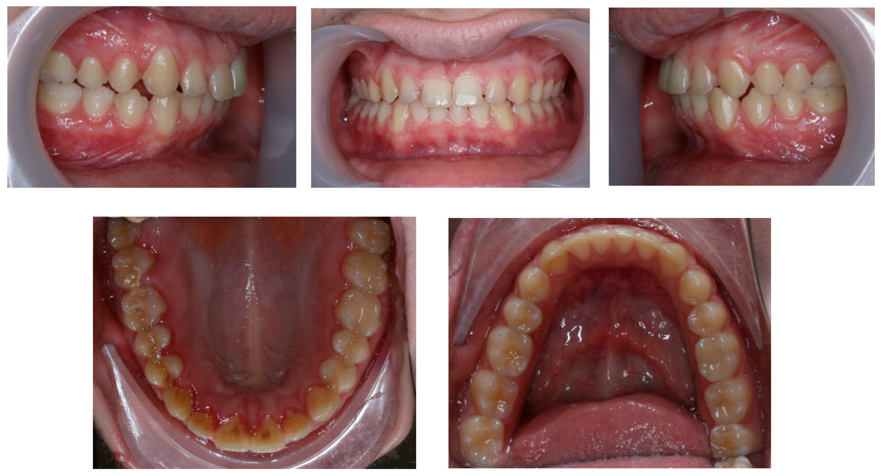 Children 11 00358 g010