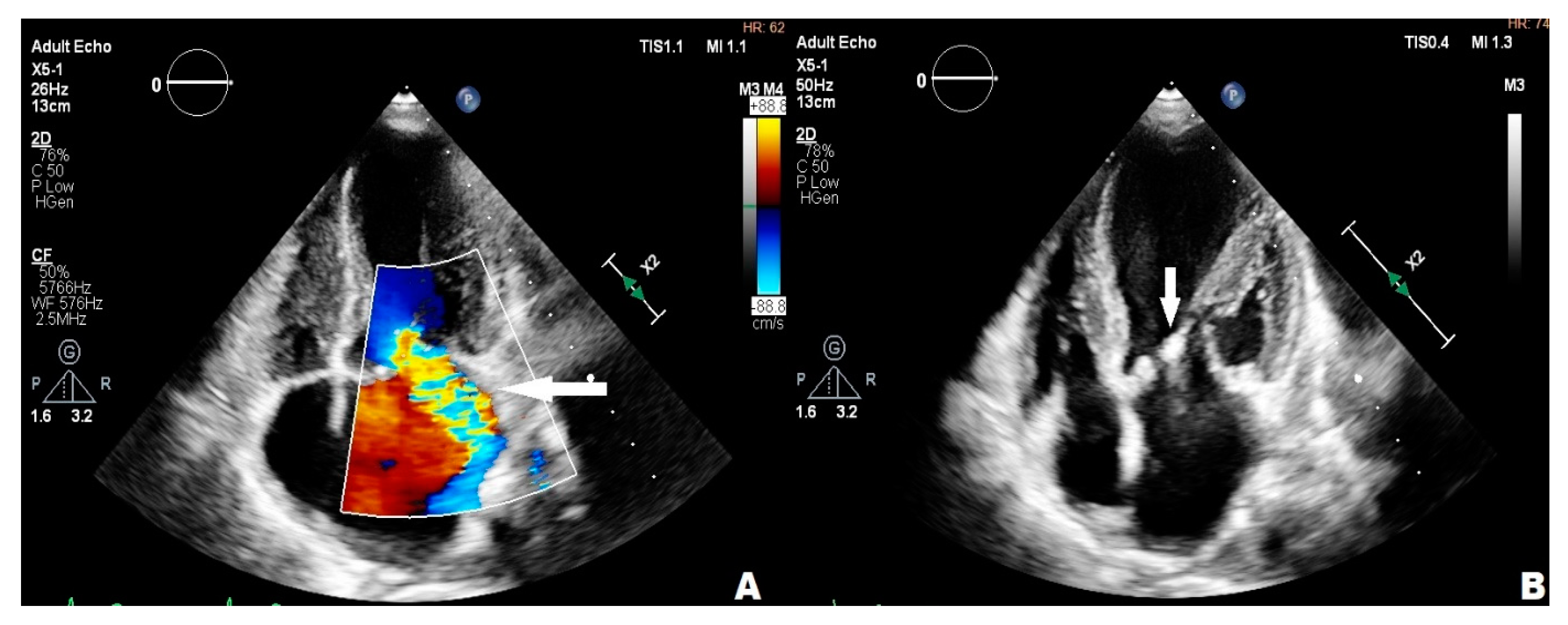 Children 11 00371 g002