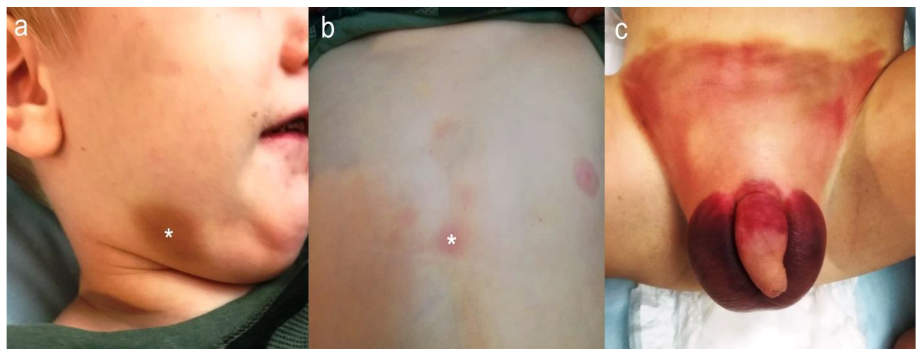 pediatric exam genital Essential skills of scrotal examination: a step‐by‐step technique - Please  - 2022 - Trends in Urology & Men's Health - Wiley Online Library