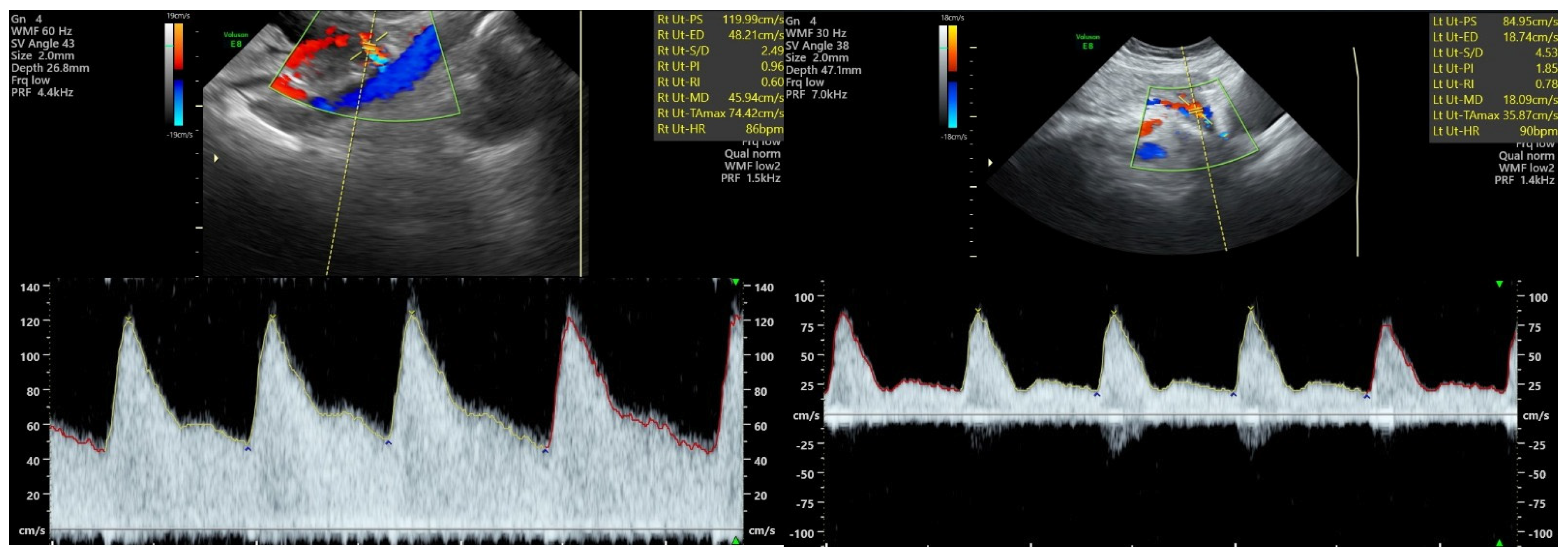 Children 11 00468 g001