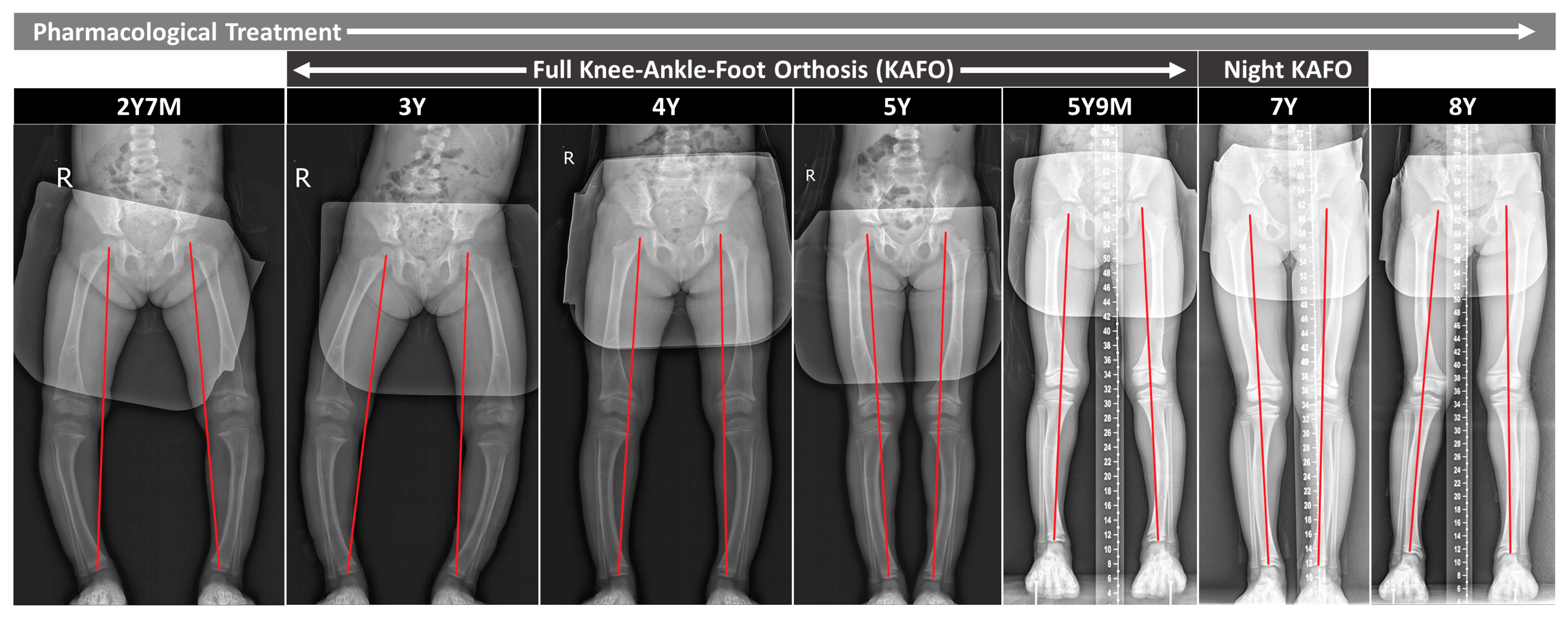 Children 11 00487 g002