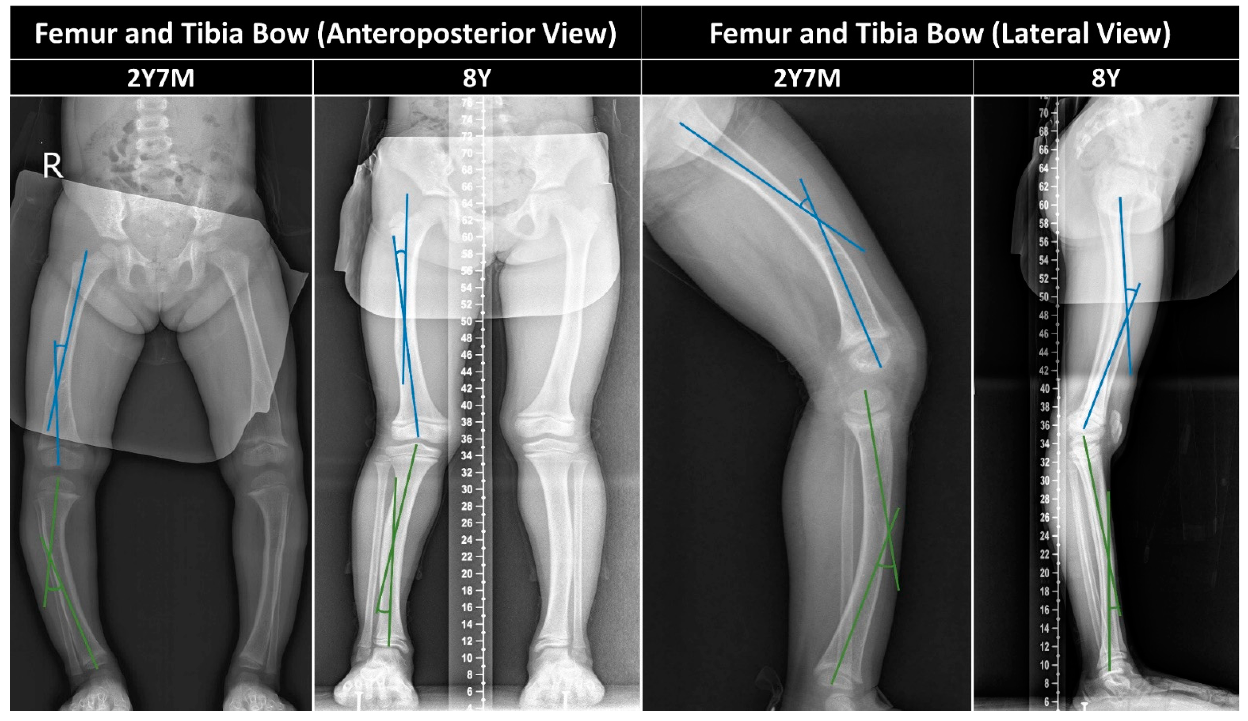 Children 11 00487 g003