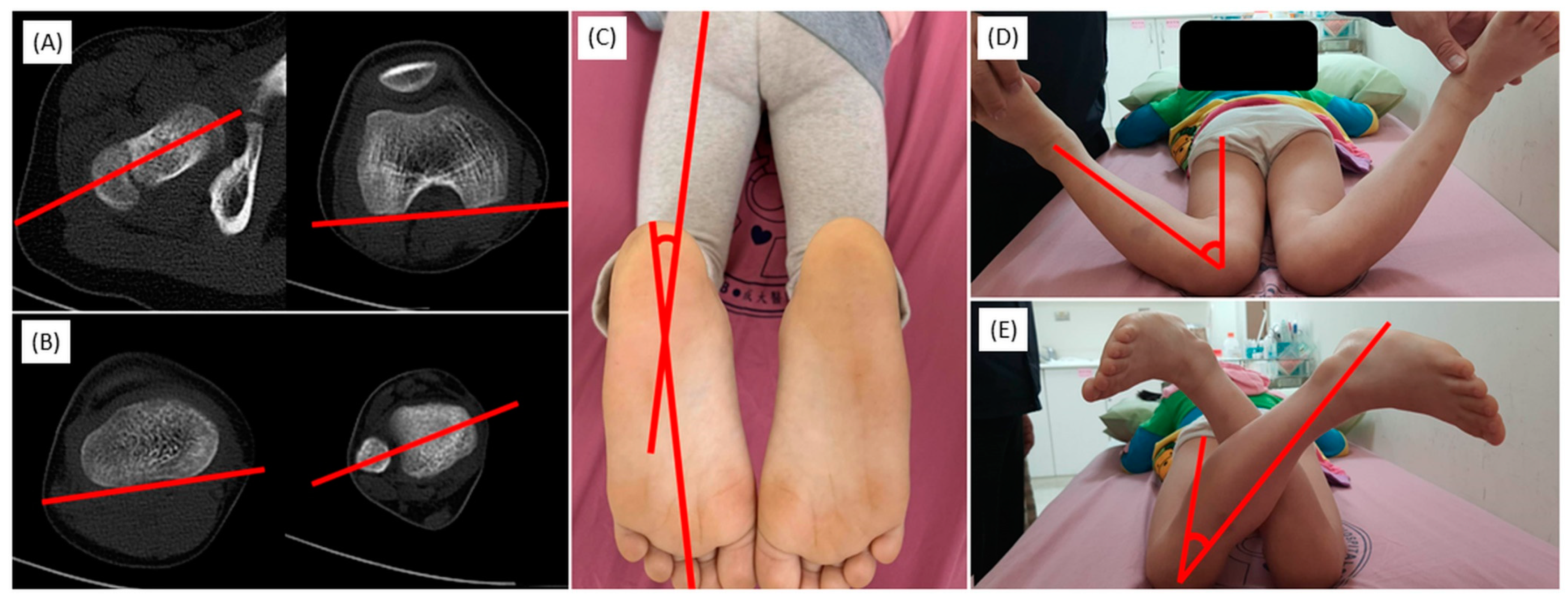 Children 11 00487 g004