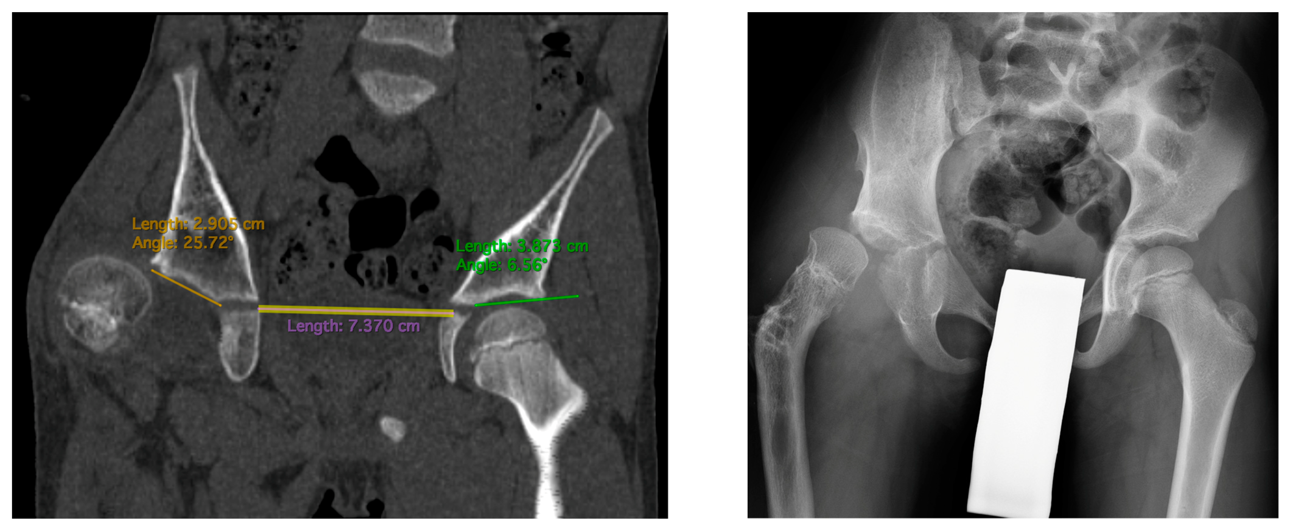 Children 11 00500 g003