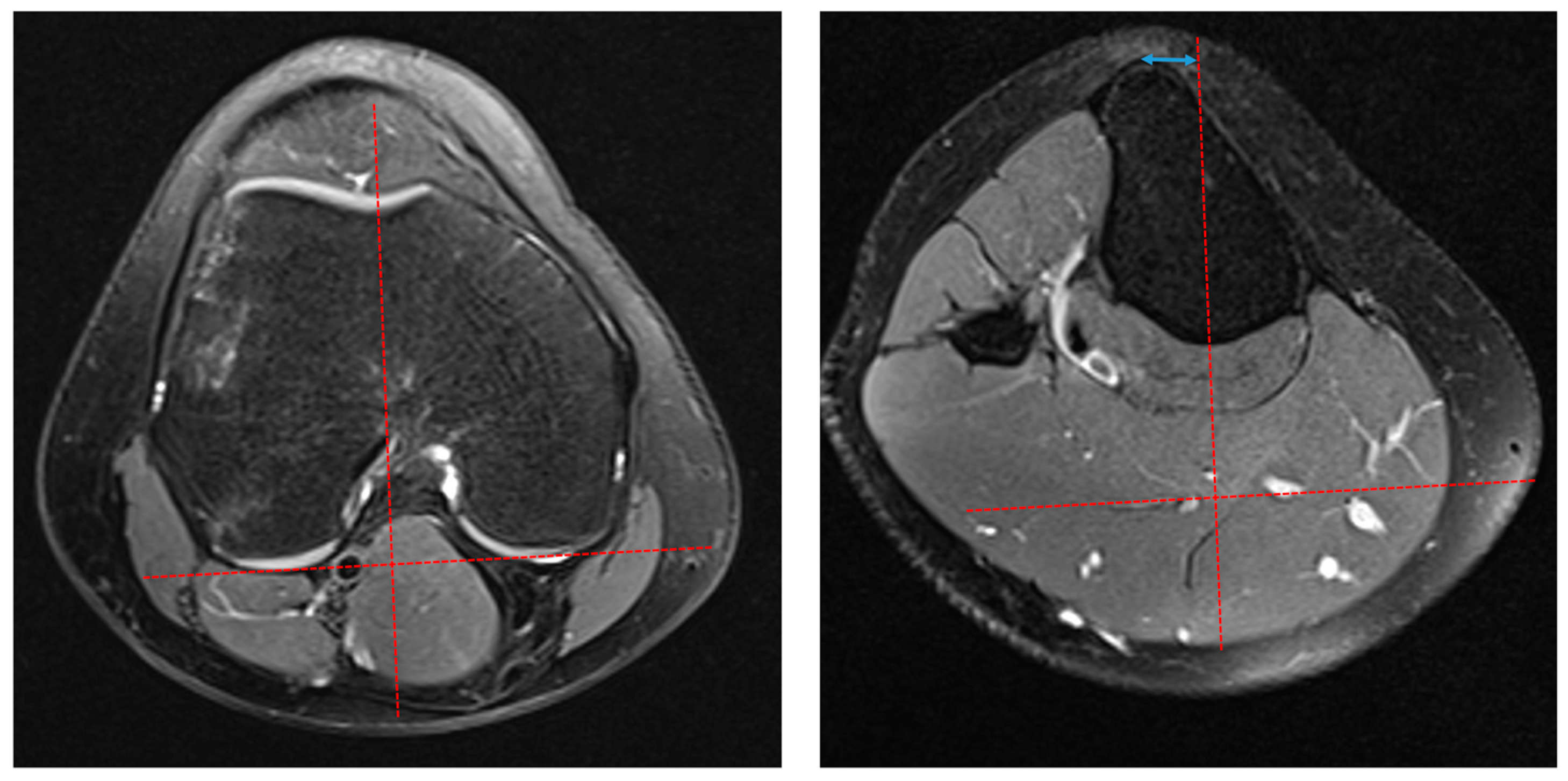 Children 11 00504 g001