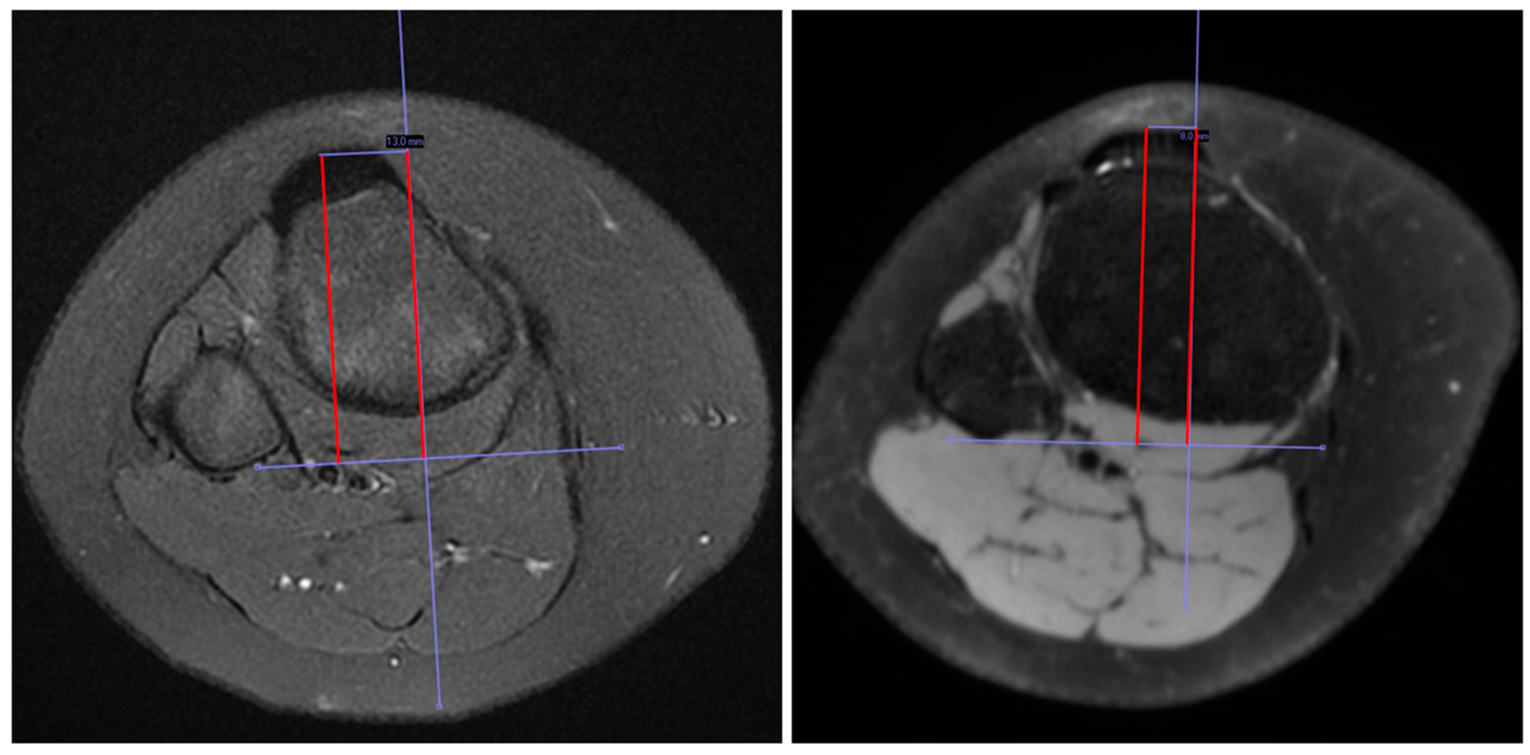 Children 11 00504 g003