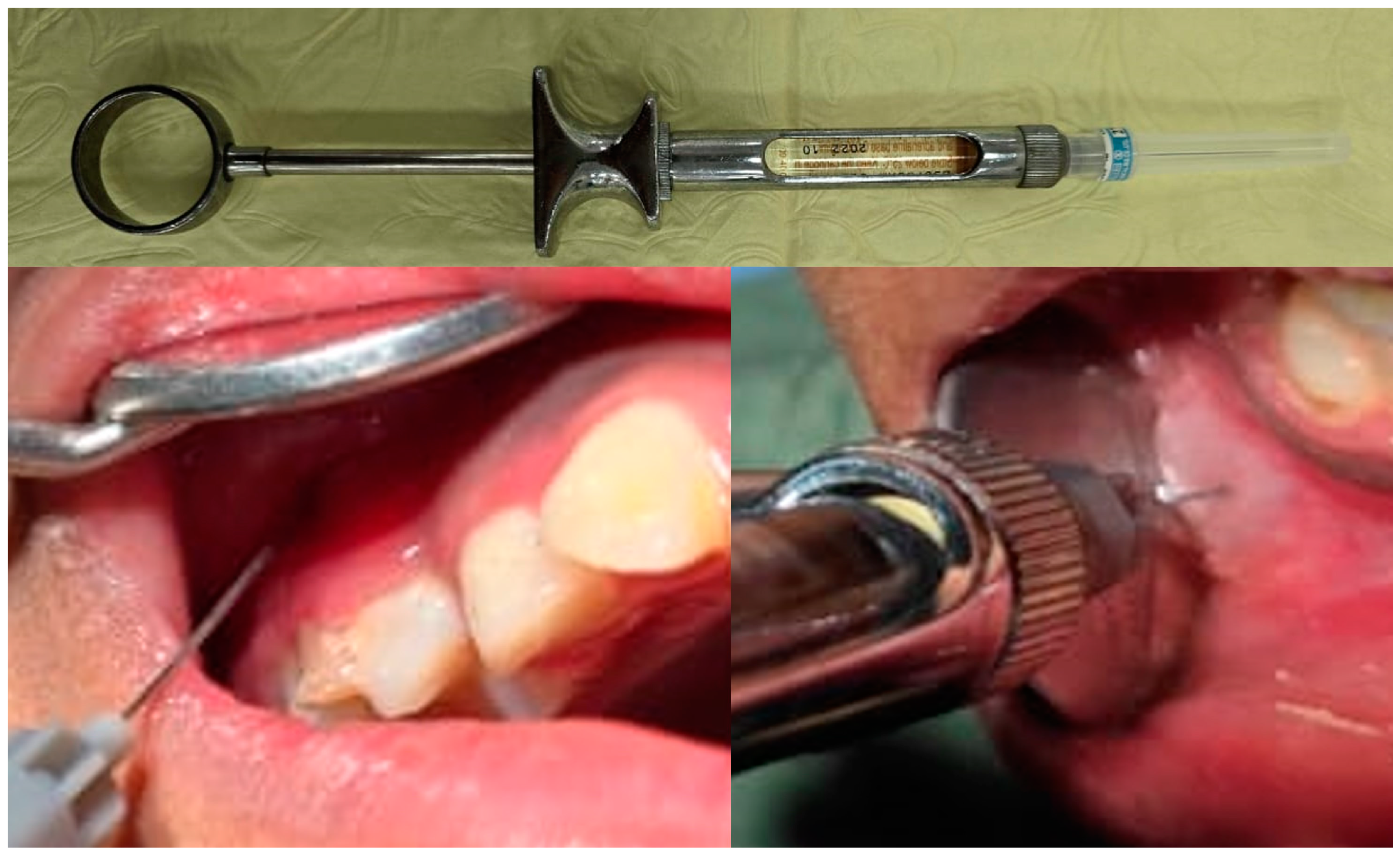 Children 11 00514 g002