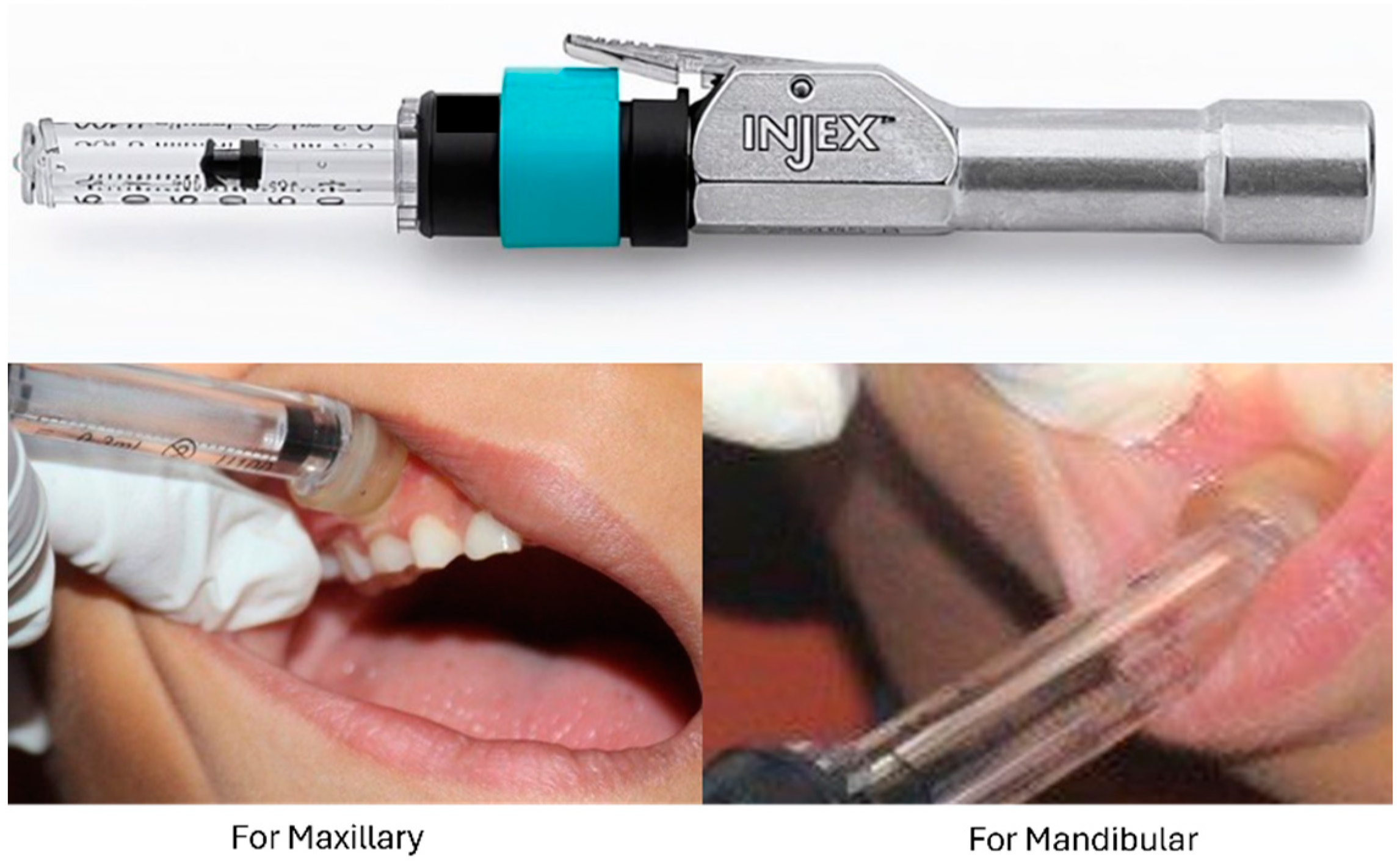 Children Free FullText Comparative Evaluation of New Needleless