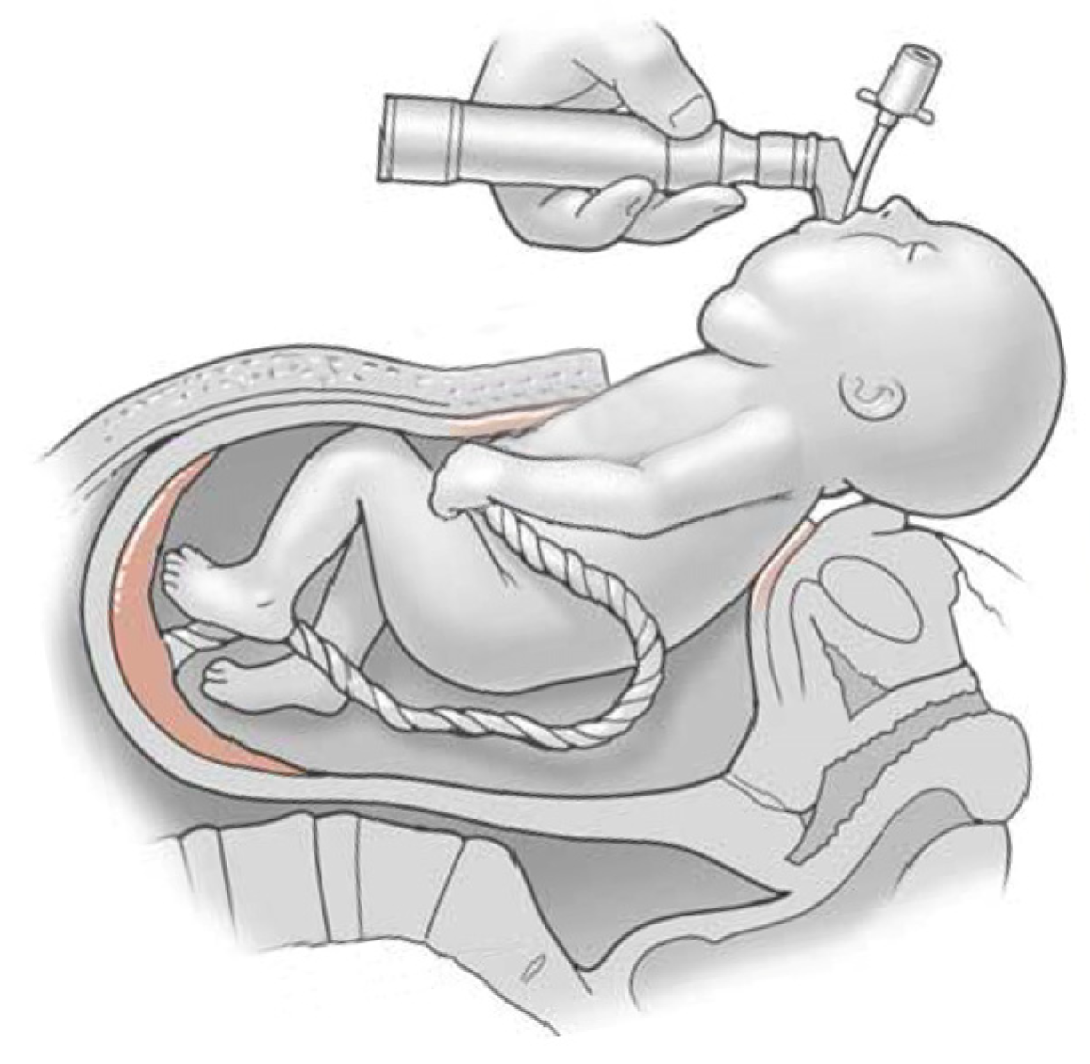 Children 11 00567 g002 Children 11 00567 g002