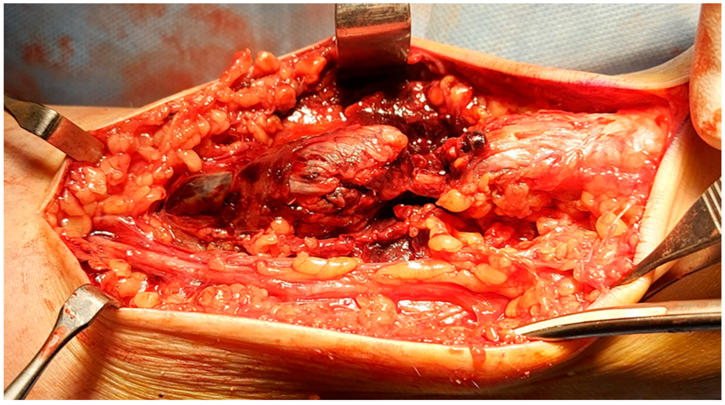 Children 11 00580 g001