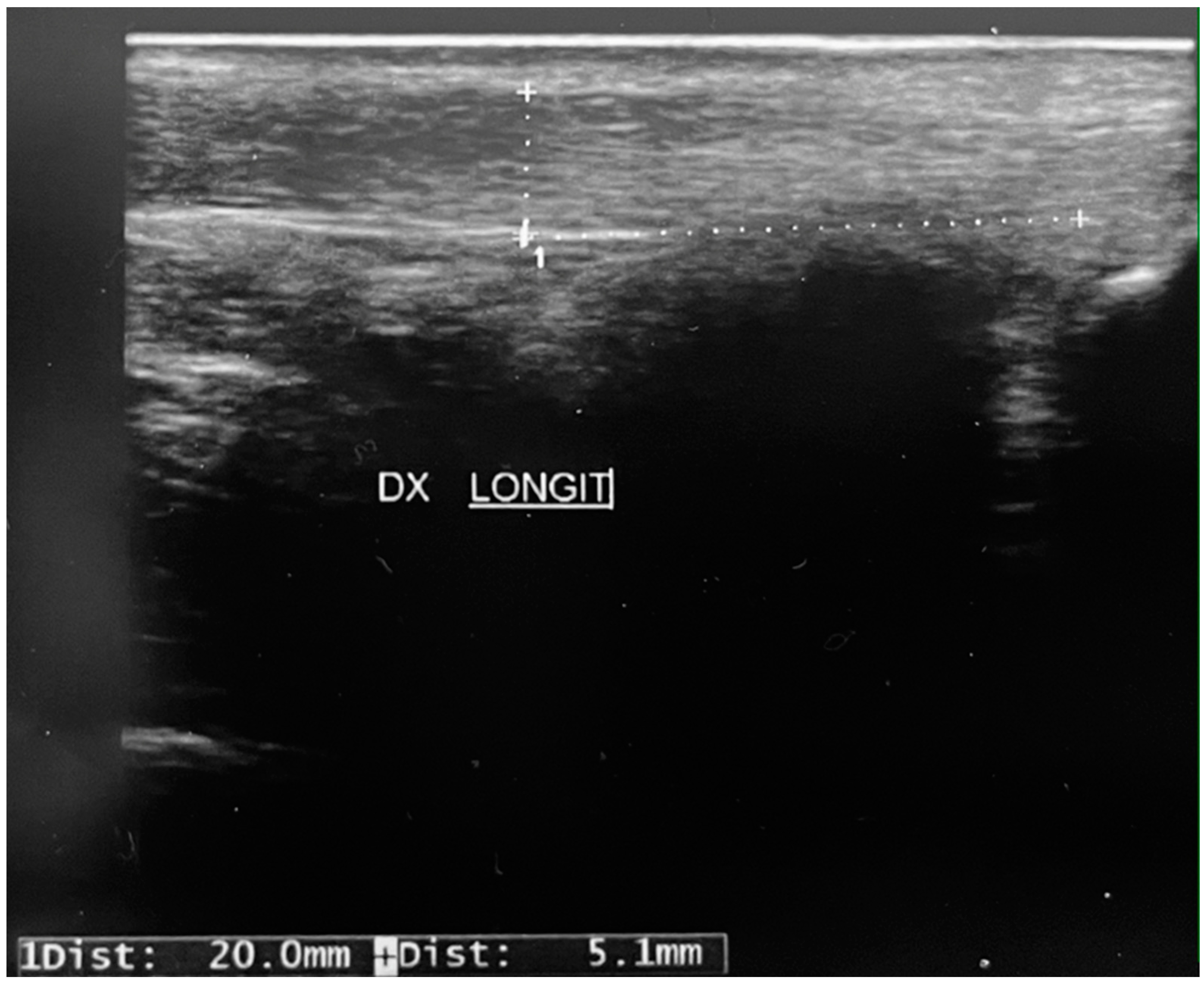 Children 11 00580 g002