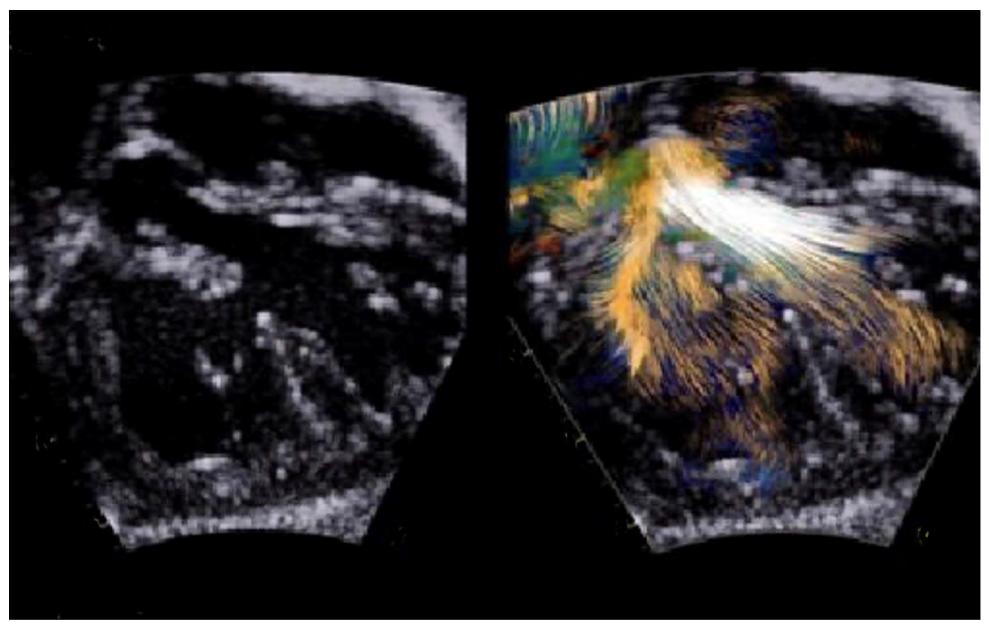 Children 11 00626 g002