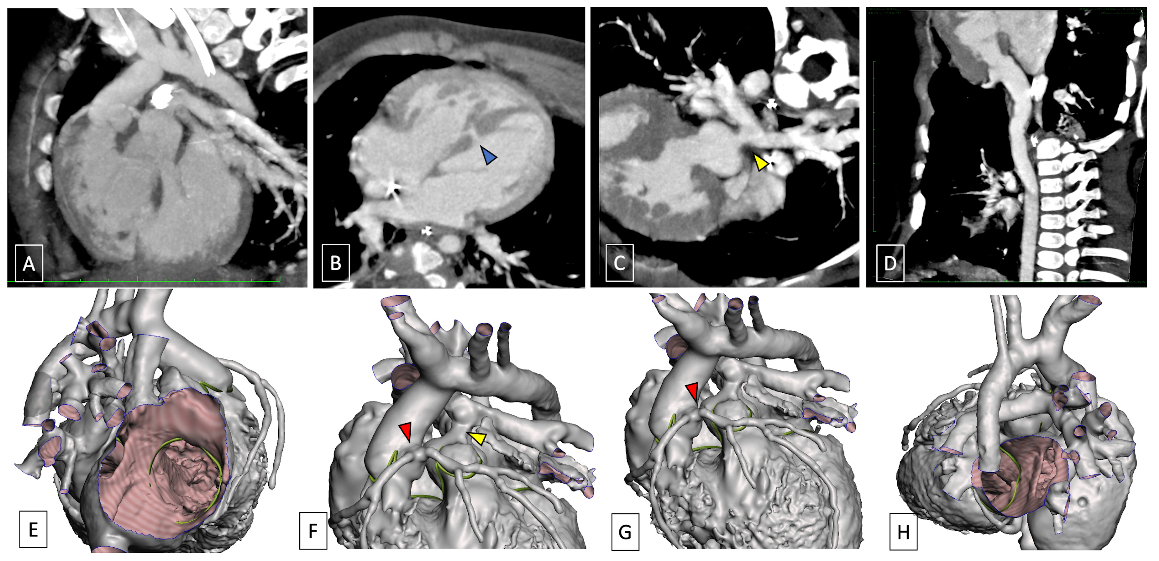 Children 11 00626 g005