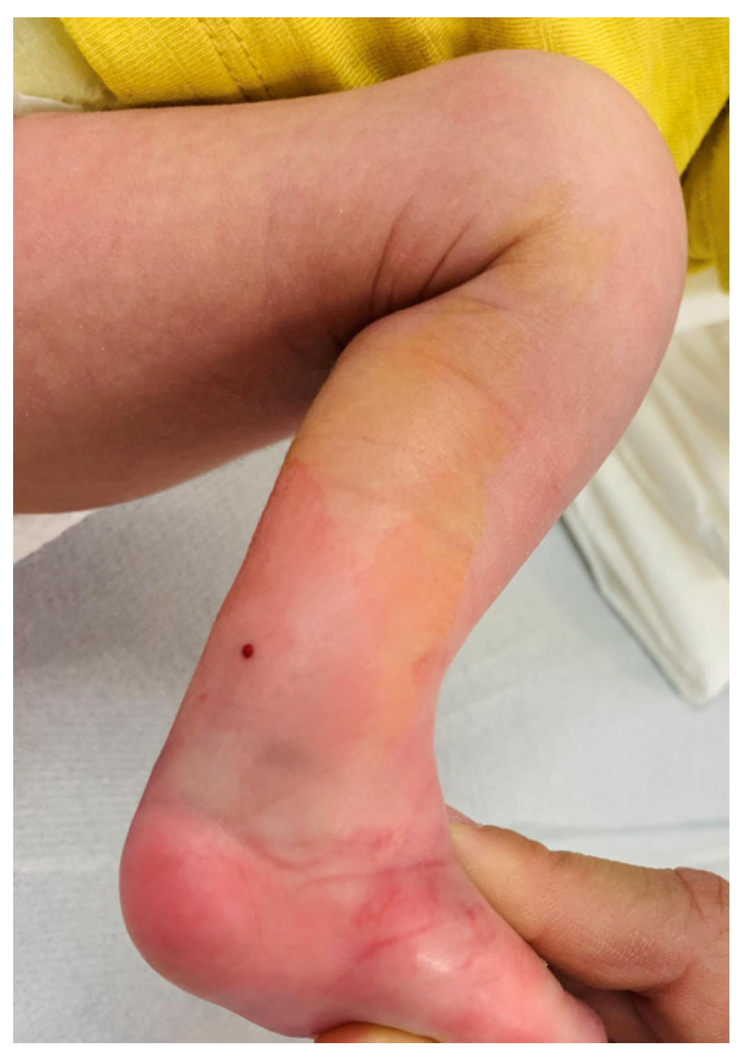 Children 11 00633 g001