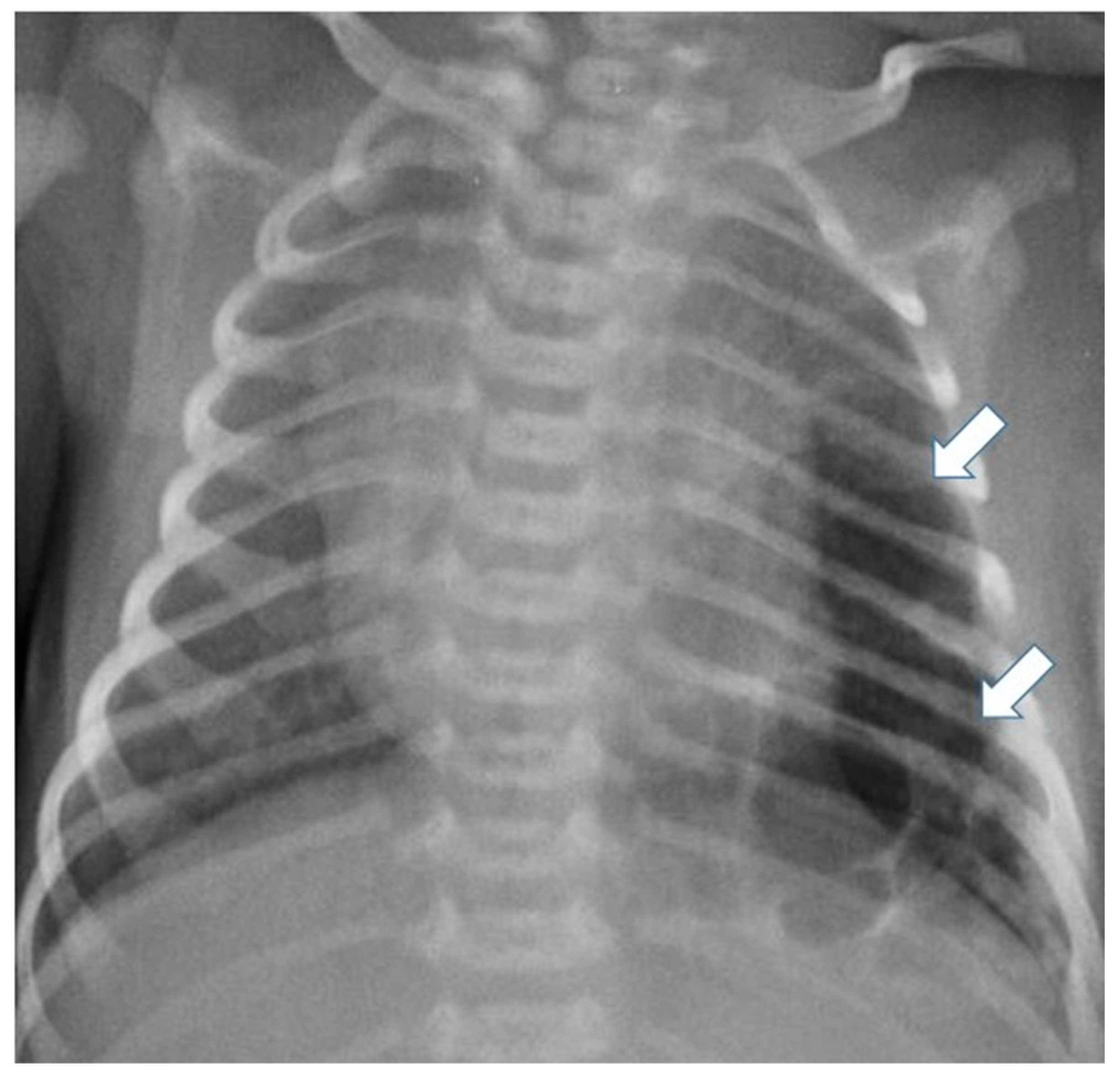 Children 11 00638 g003