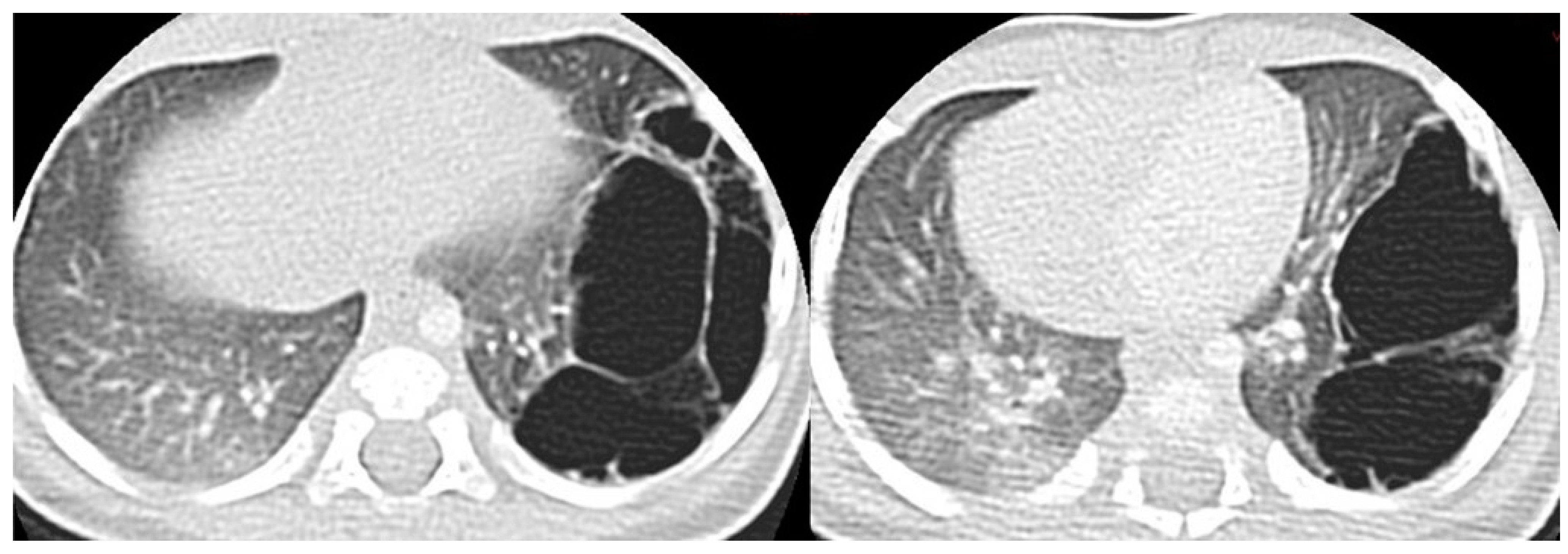 Children 11 00638 g005