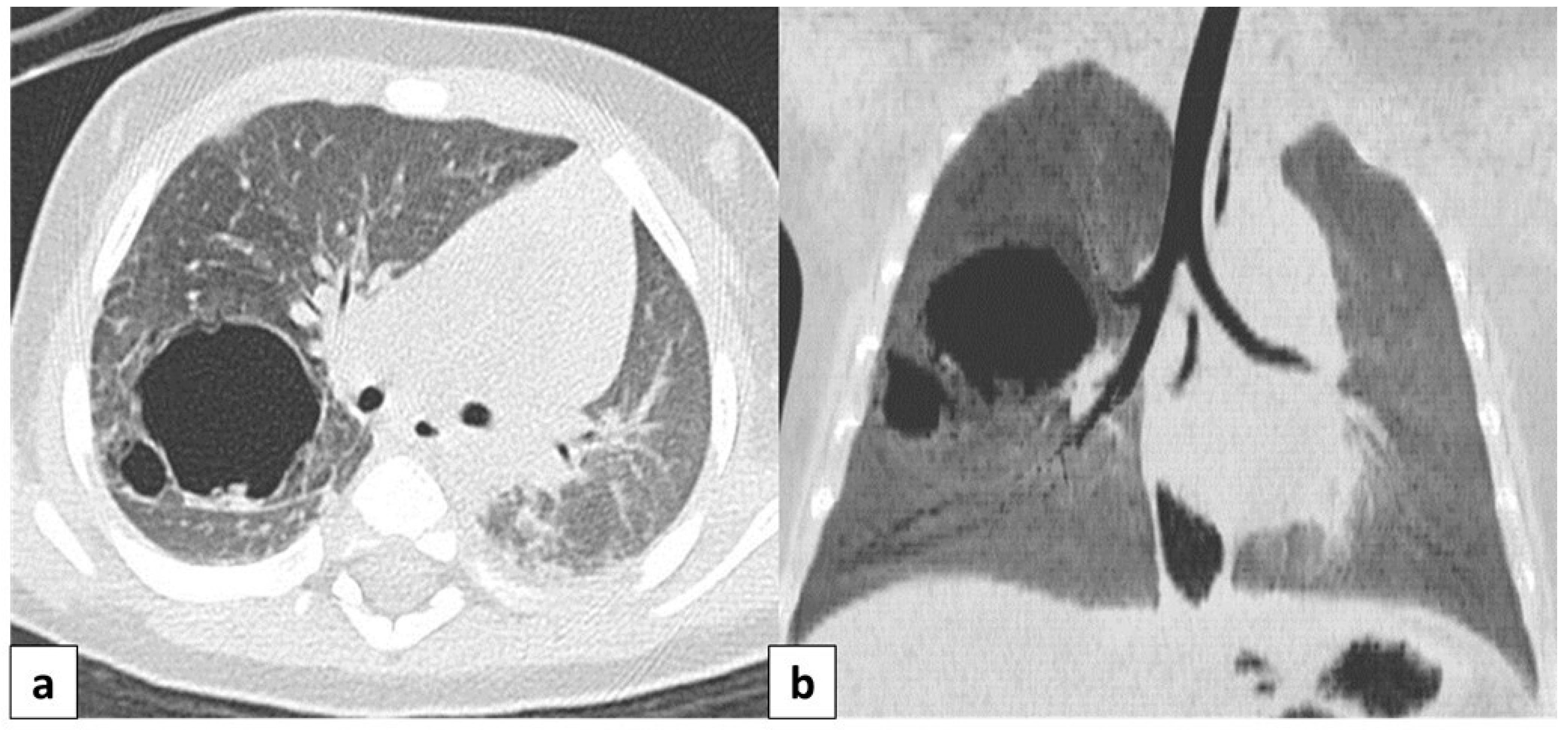 Children 11 00638 g006