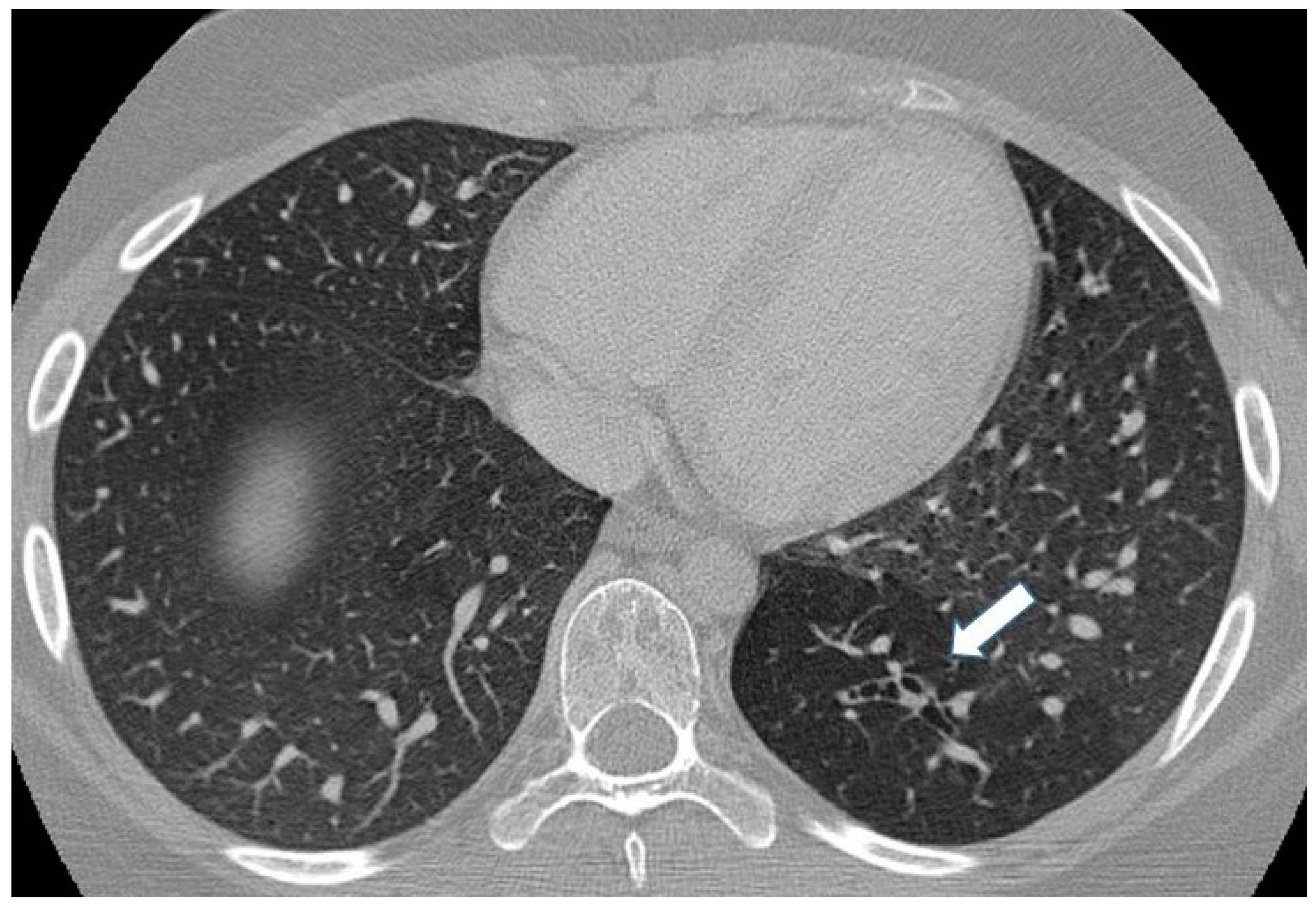 Children 11 00638 g010