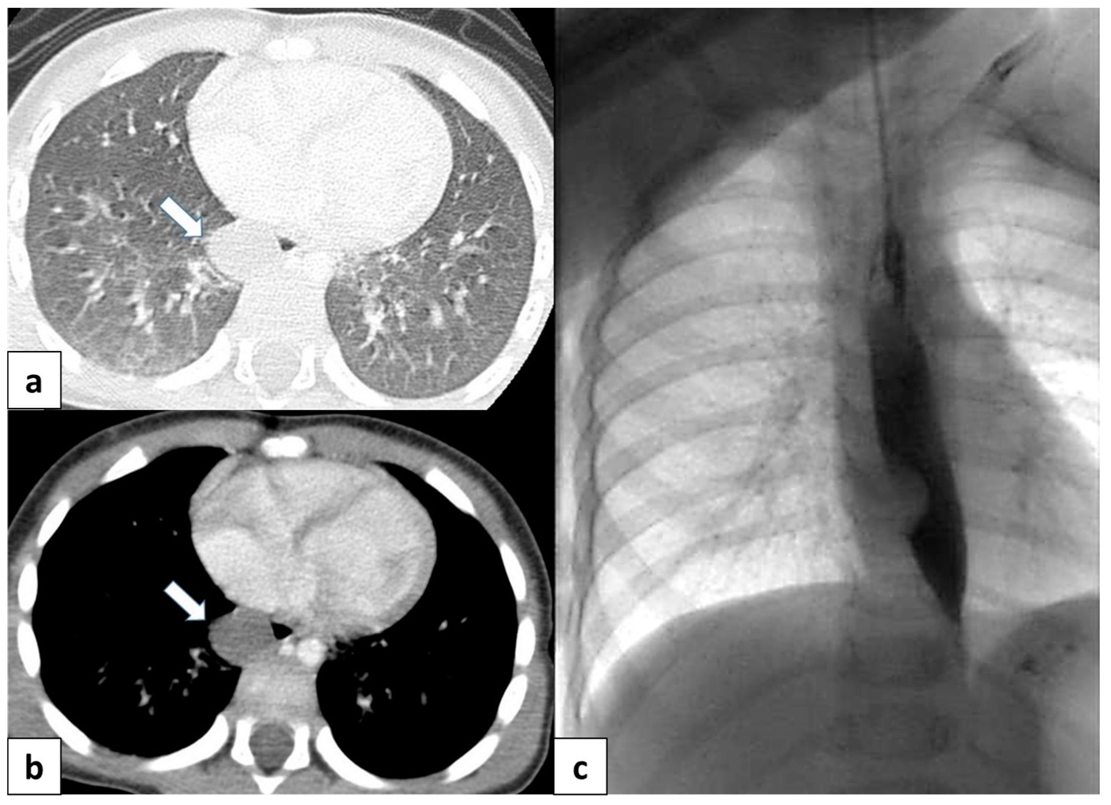 Children 11 00638 g011