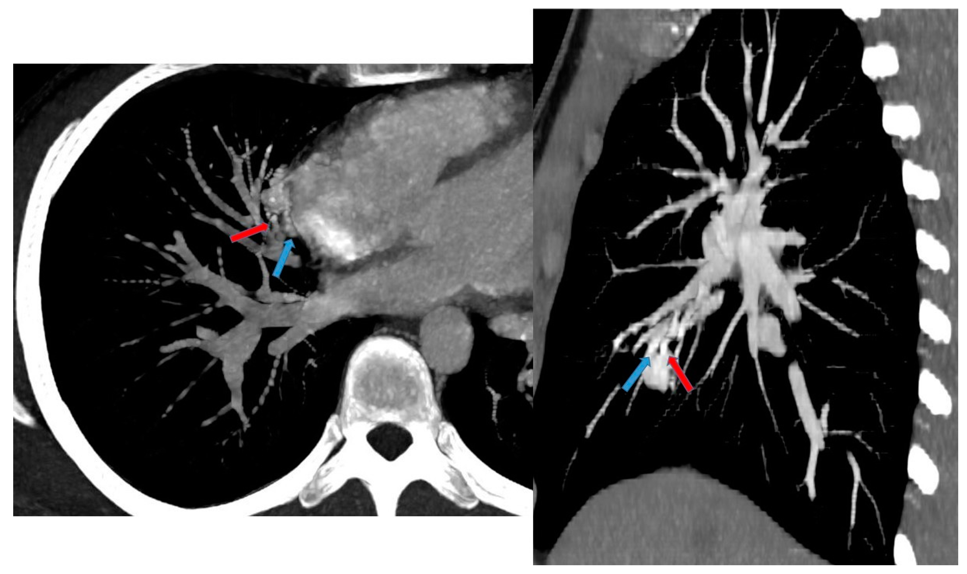 Children 11 00638 g012