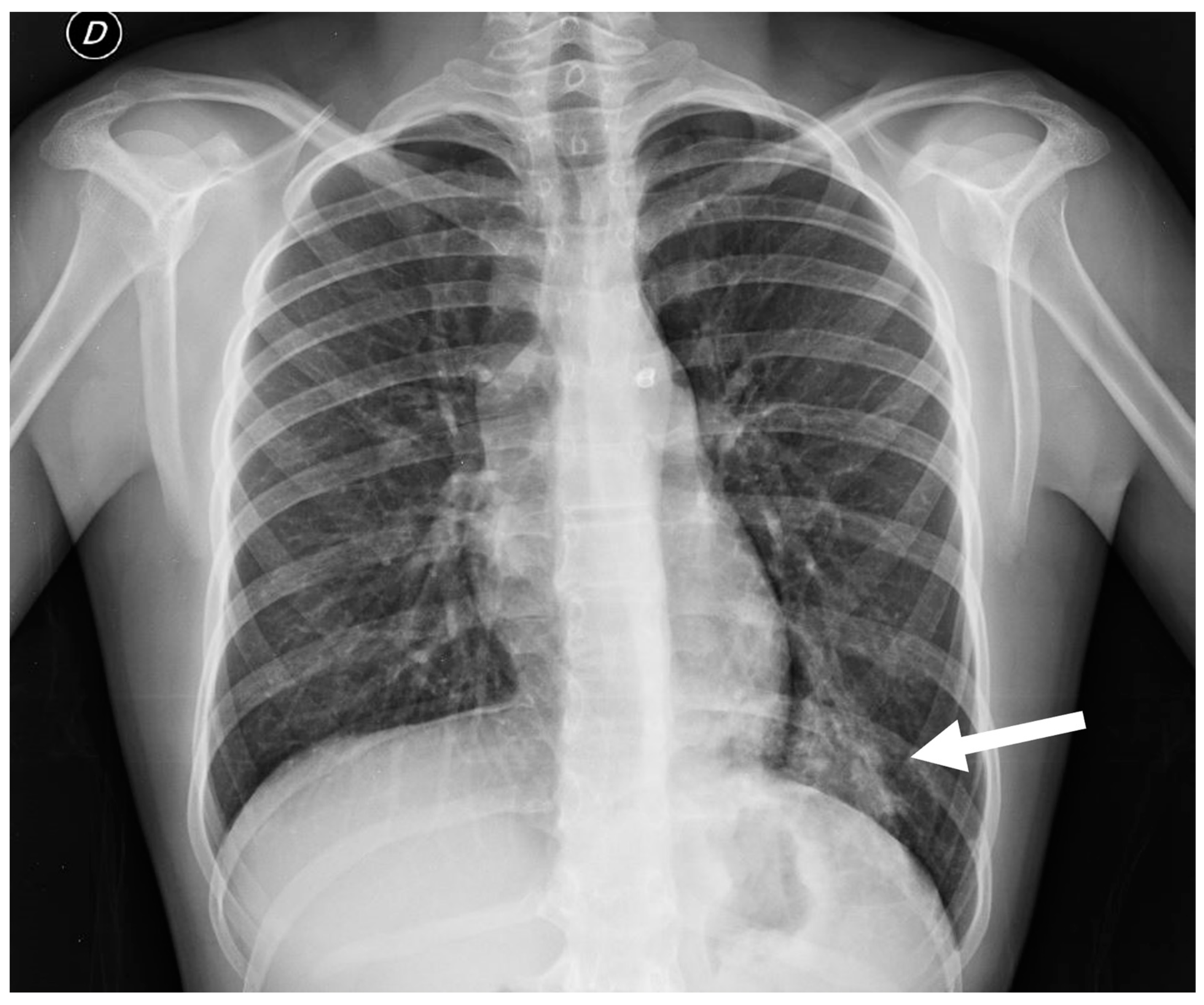 Children 11 00638 g013