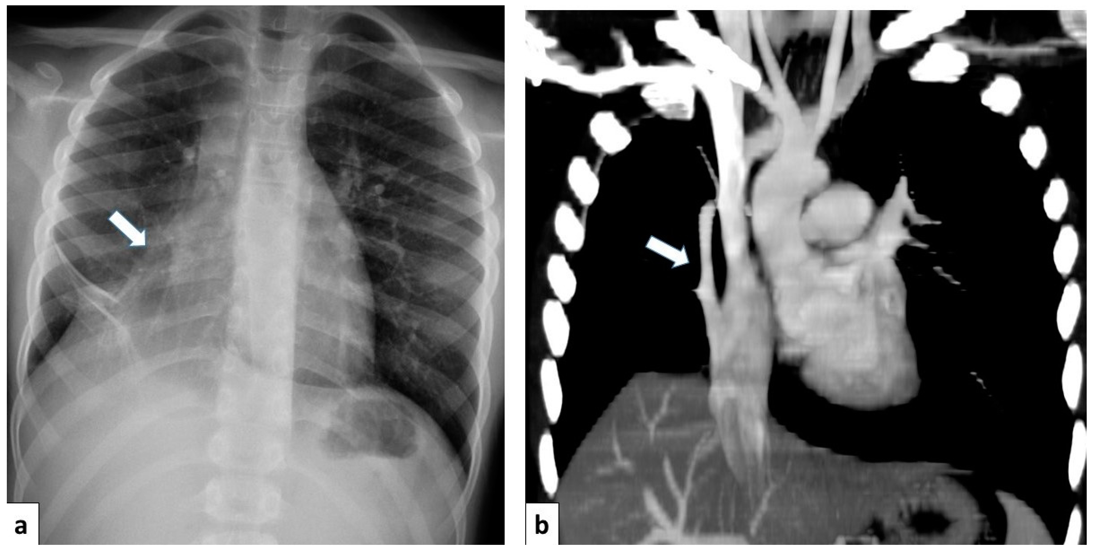 Children 11 00638 g017