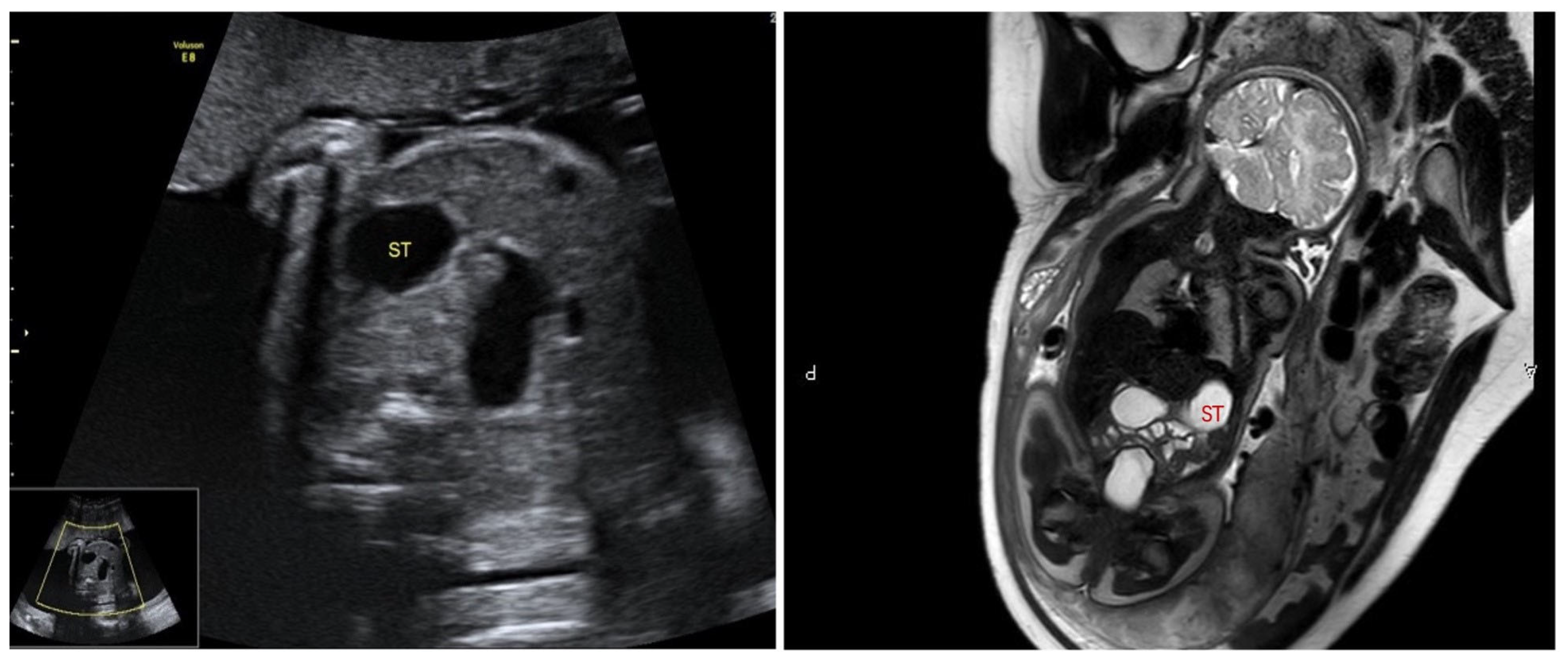 Children 11 00670 g001