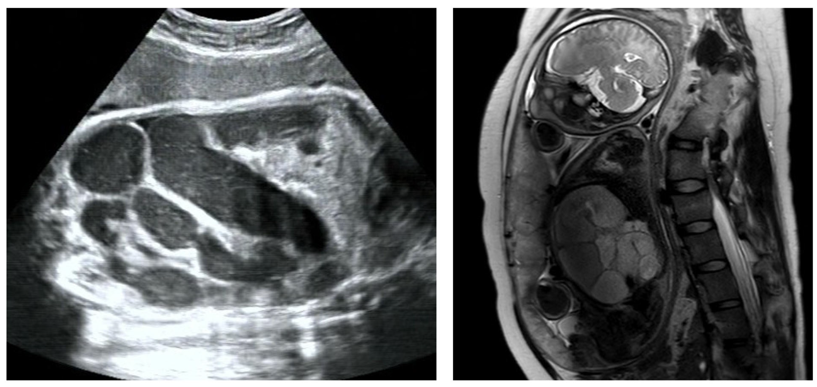 Children 11 00670 g002