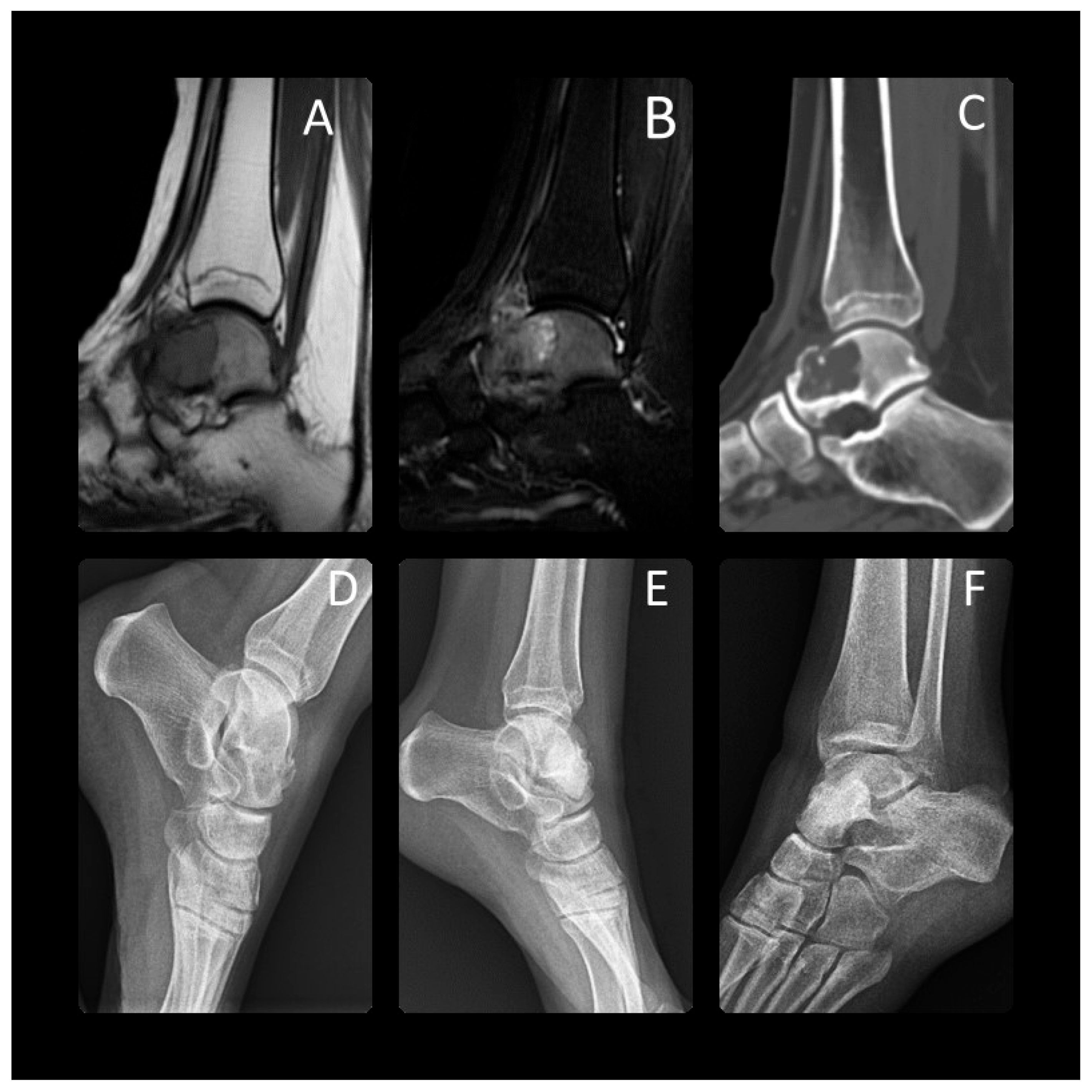 Children 11 00672 g001