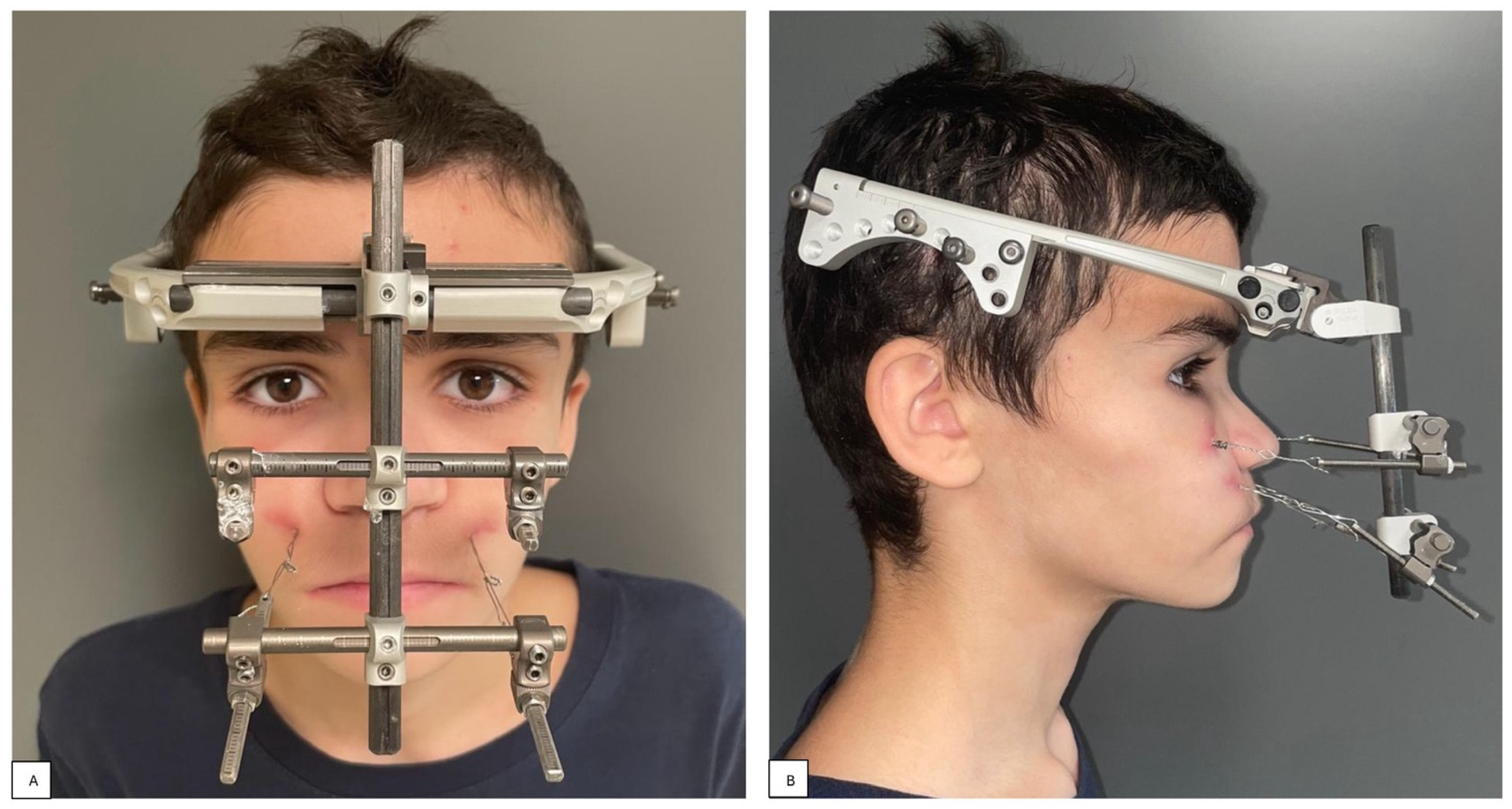 Children 11 00720 g005