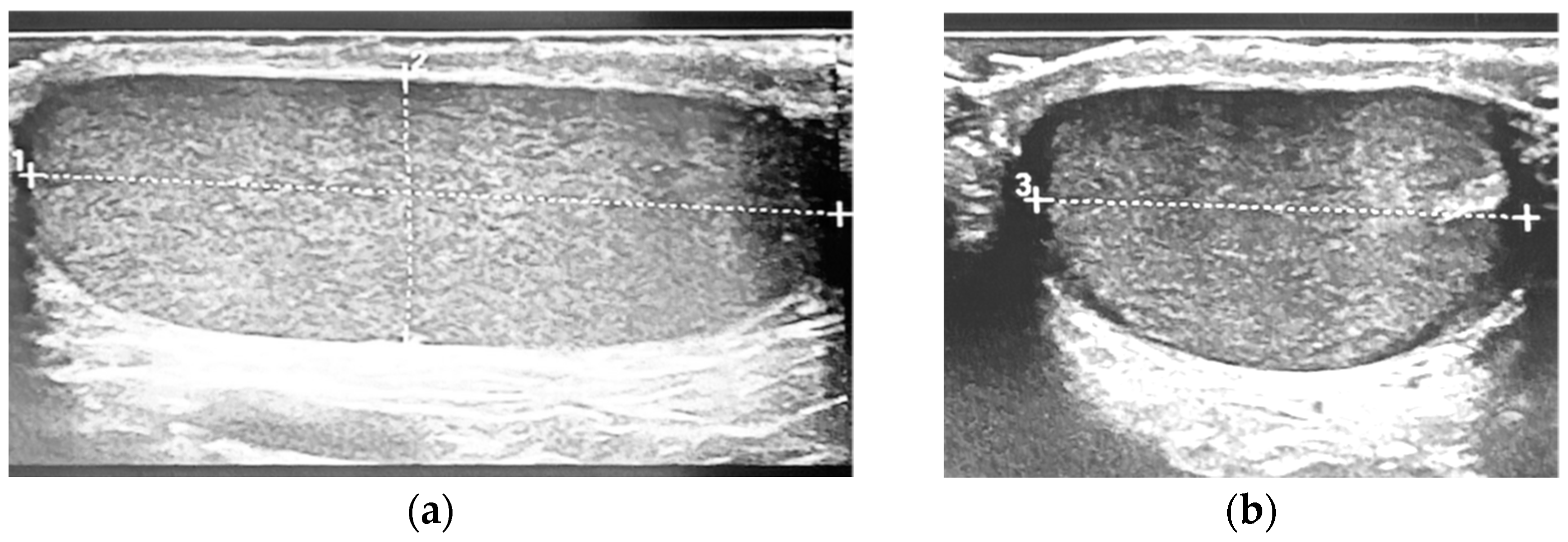 Children 11 00741 g001