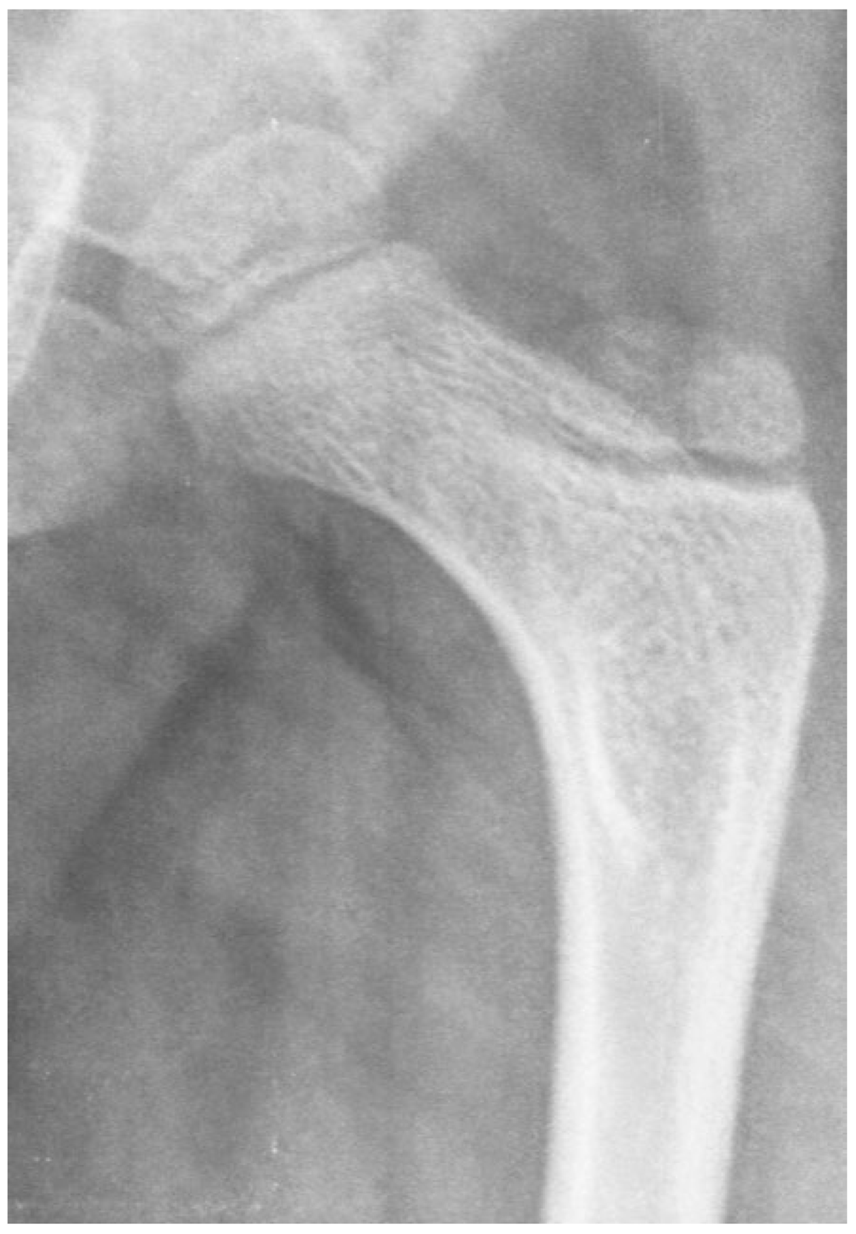 Children 11 00844 g011