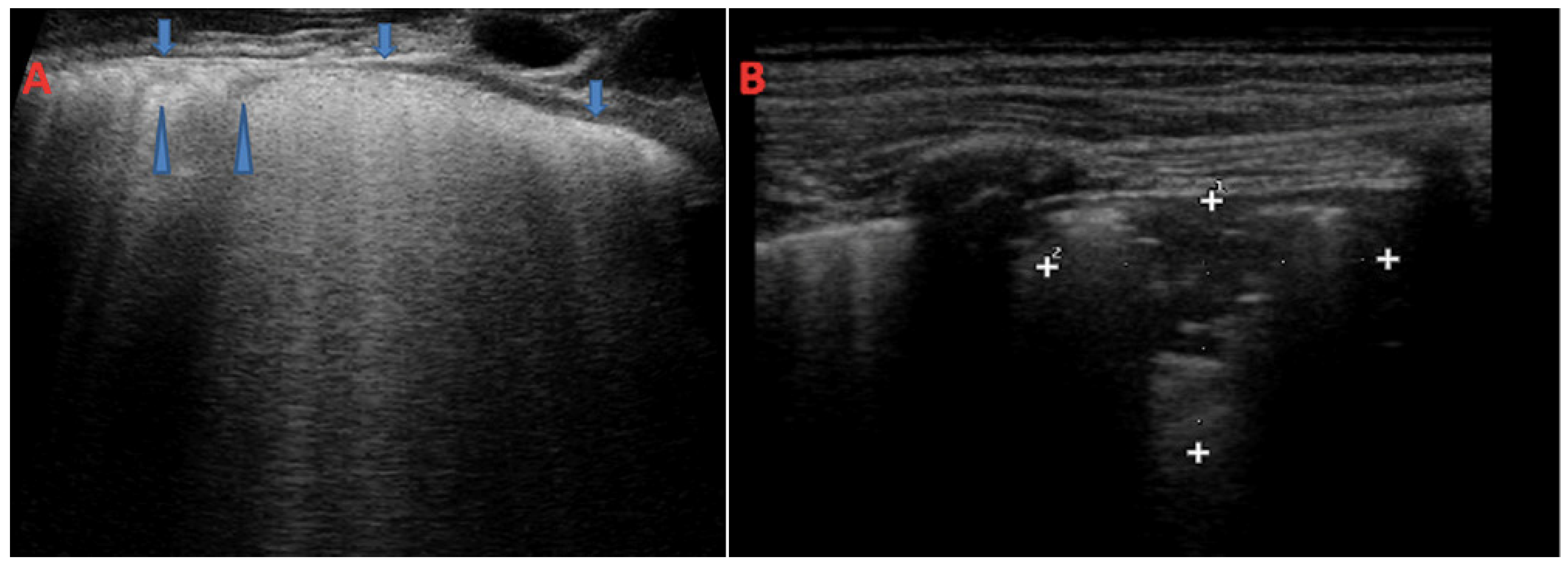 Children 11 00917 g003 Children 11 00917 g003