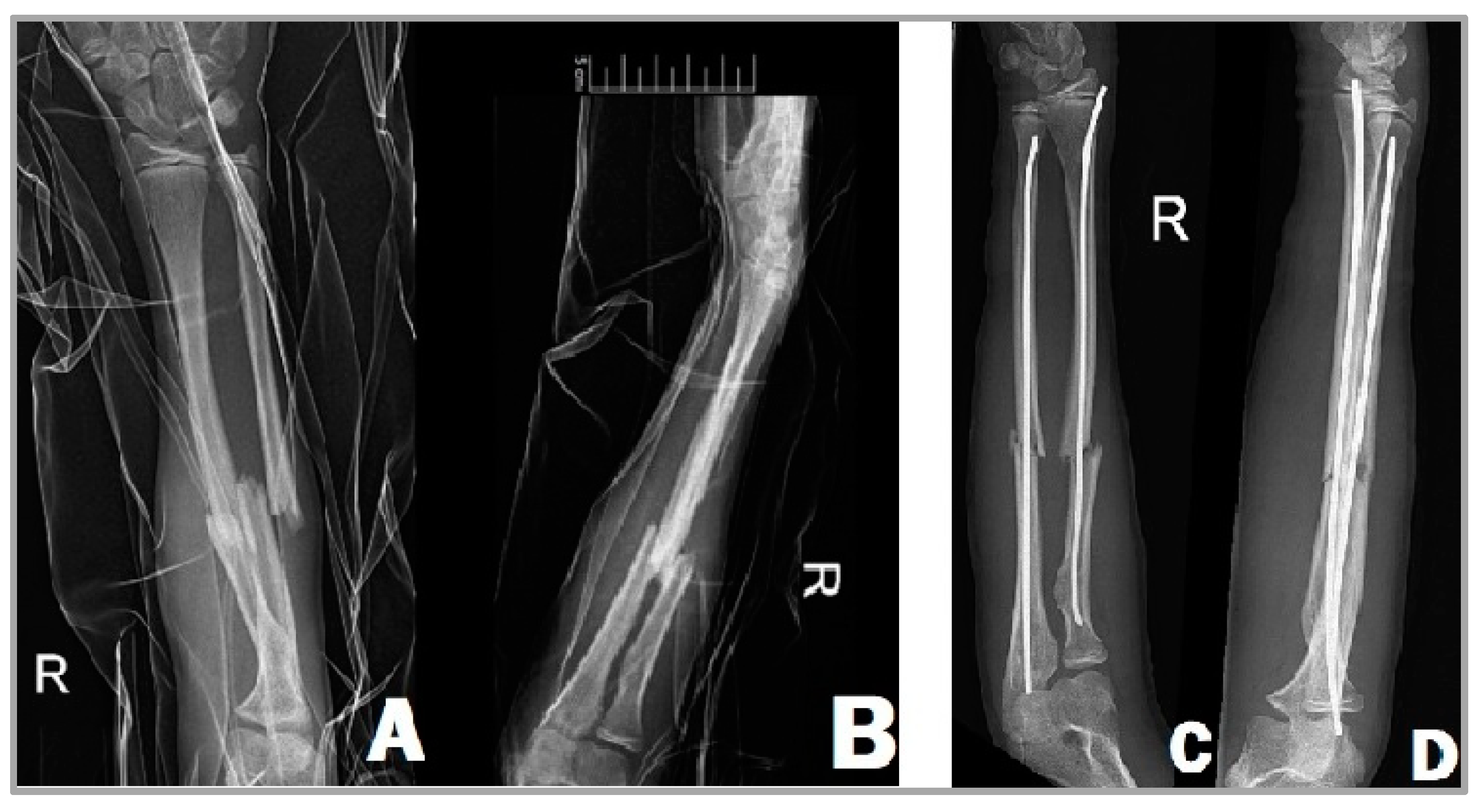 Children 11 00942 g001