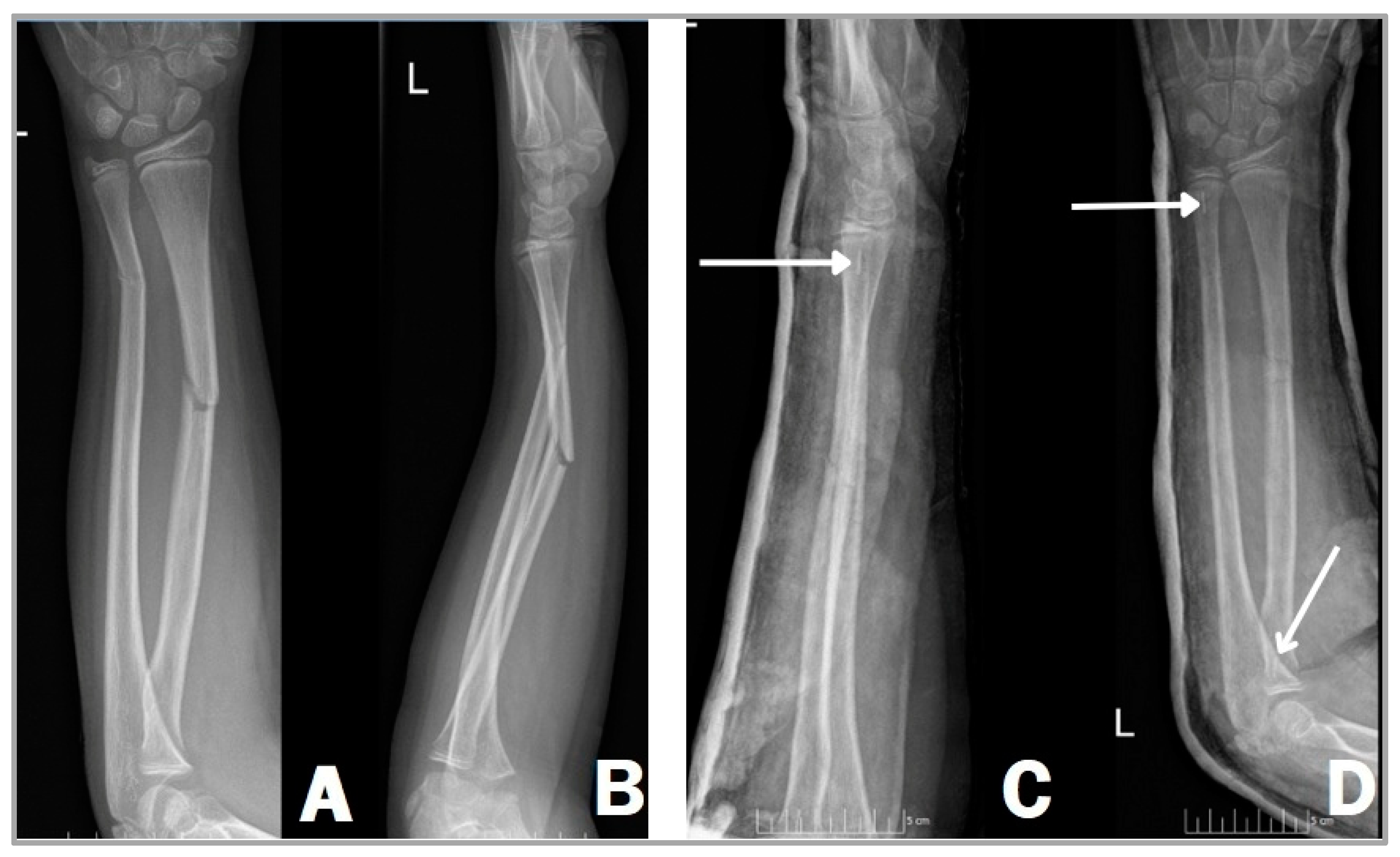 Children 11 00942 g002