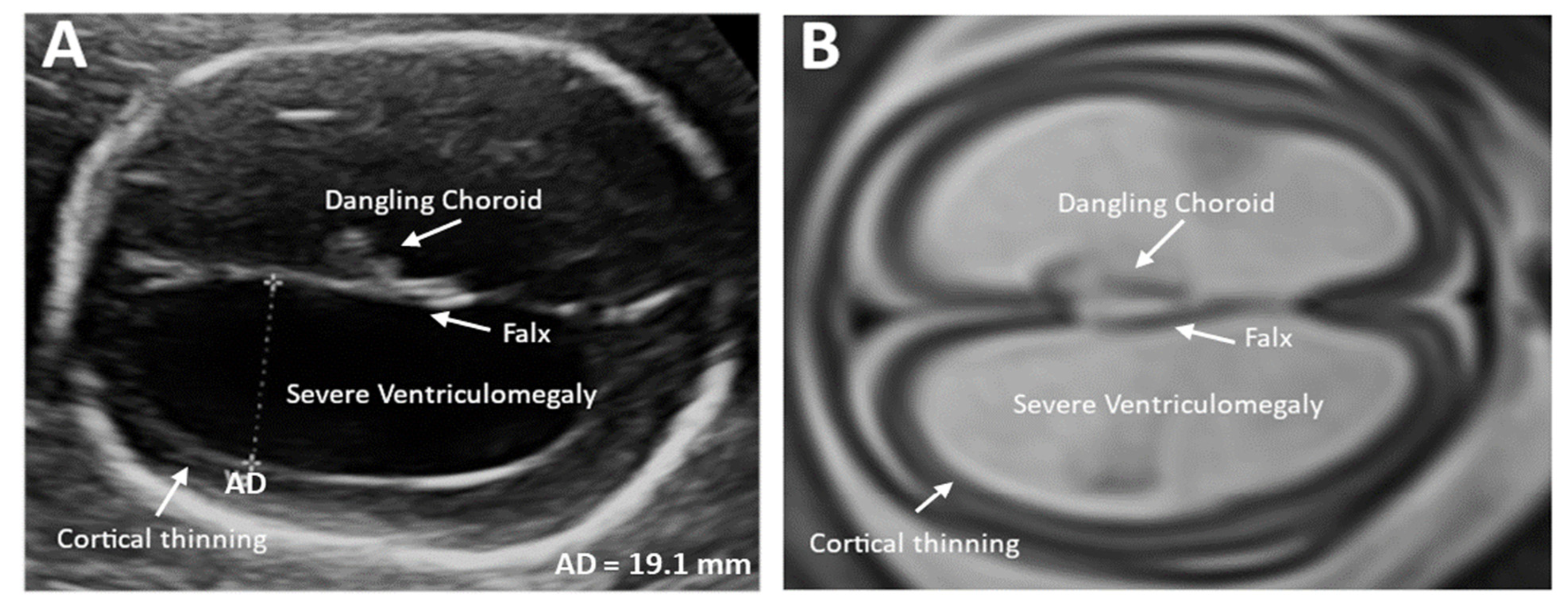 Children 11 00957 g001