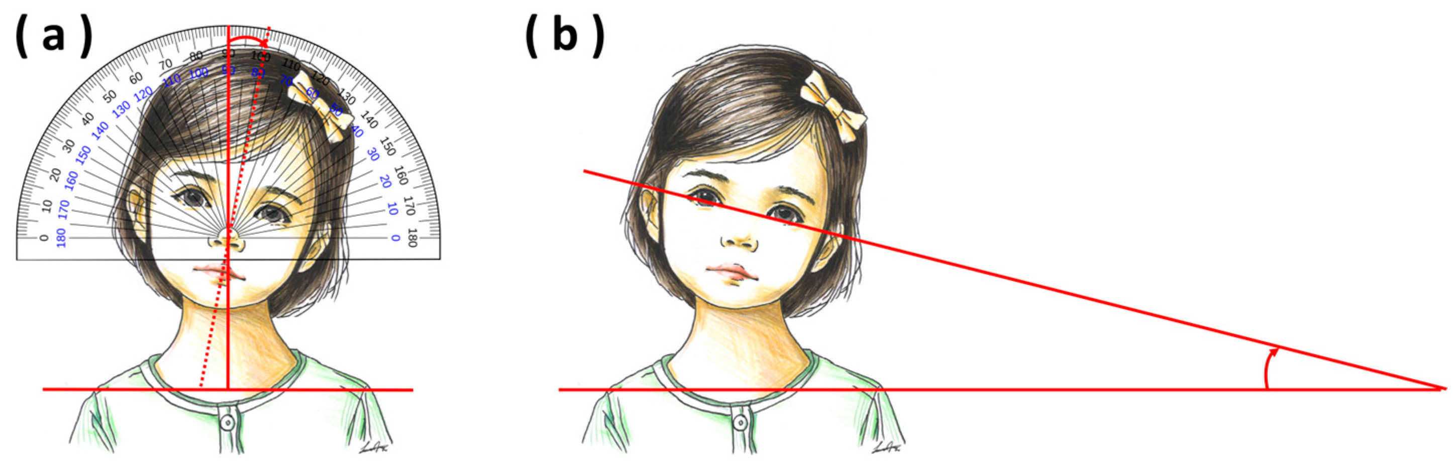 Children 11 01001 g003