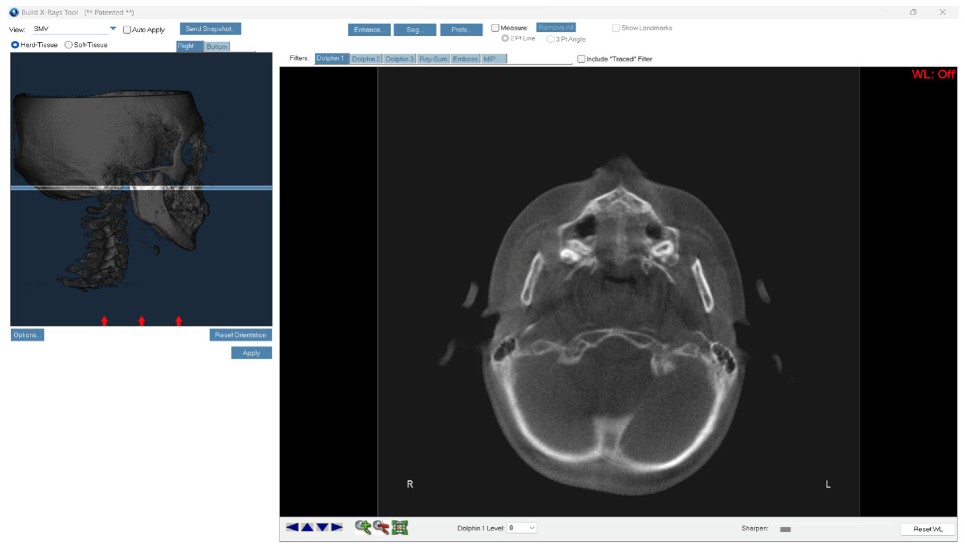 Children 11 01013 g001