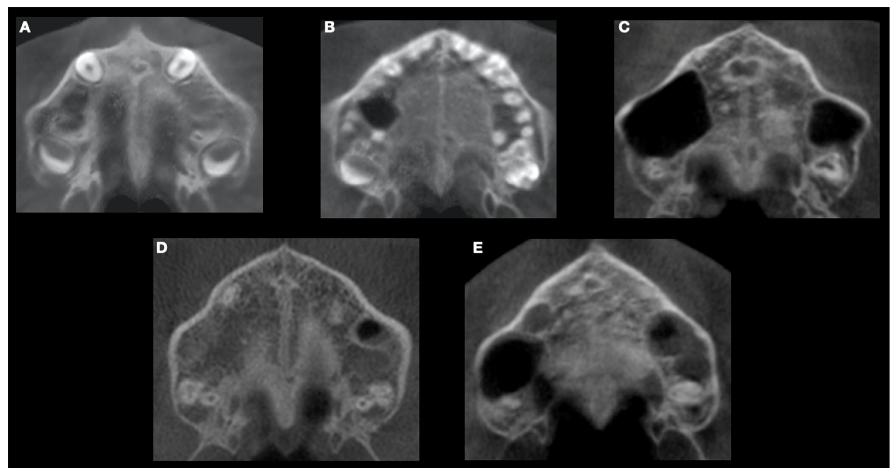 Children 11 01013 g002