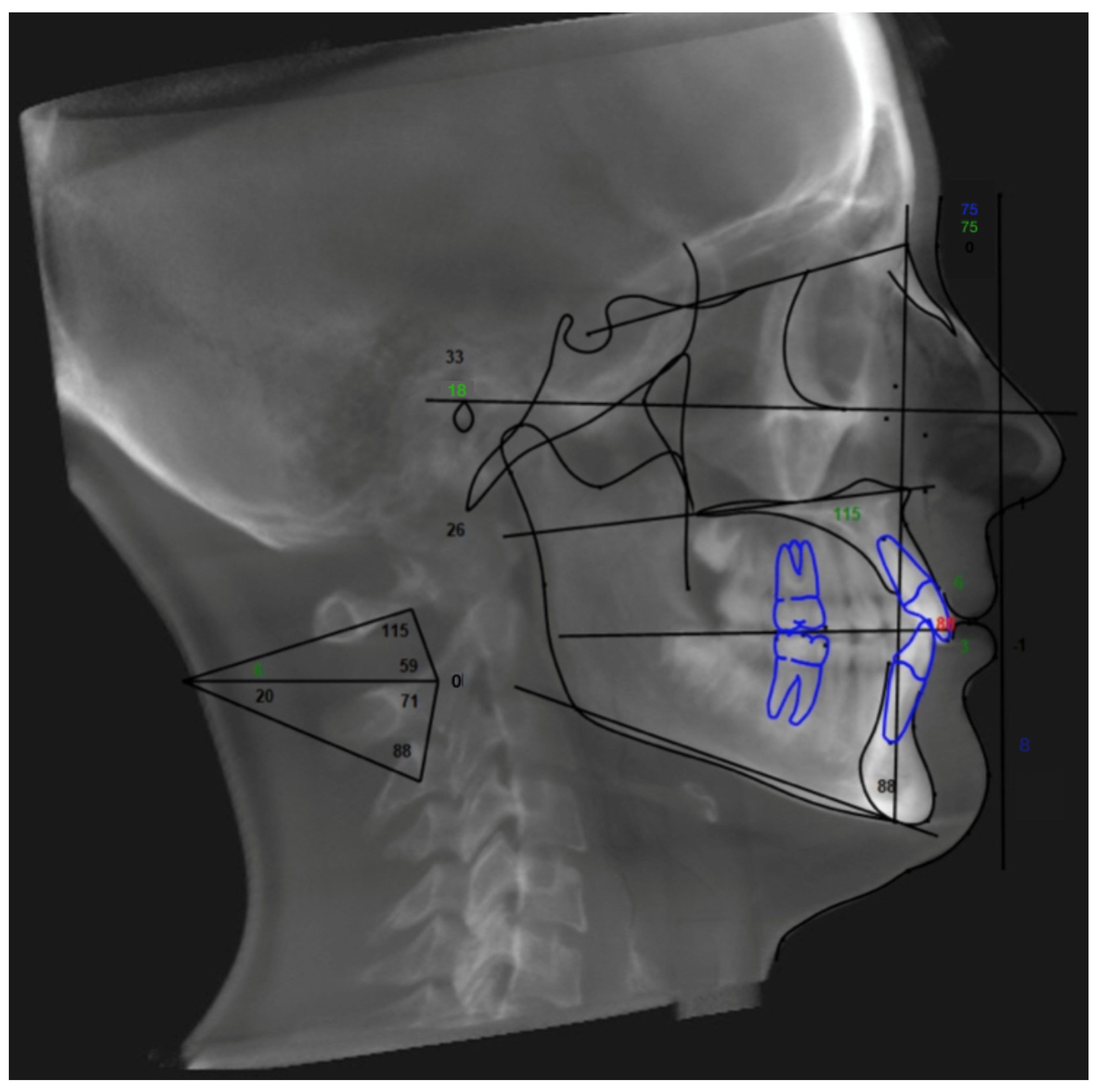 Children 11 01013 g003