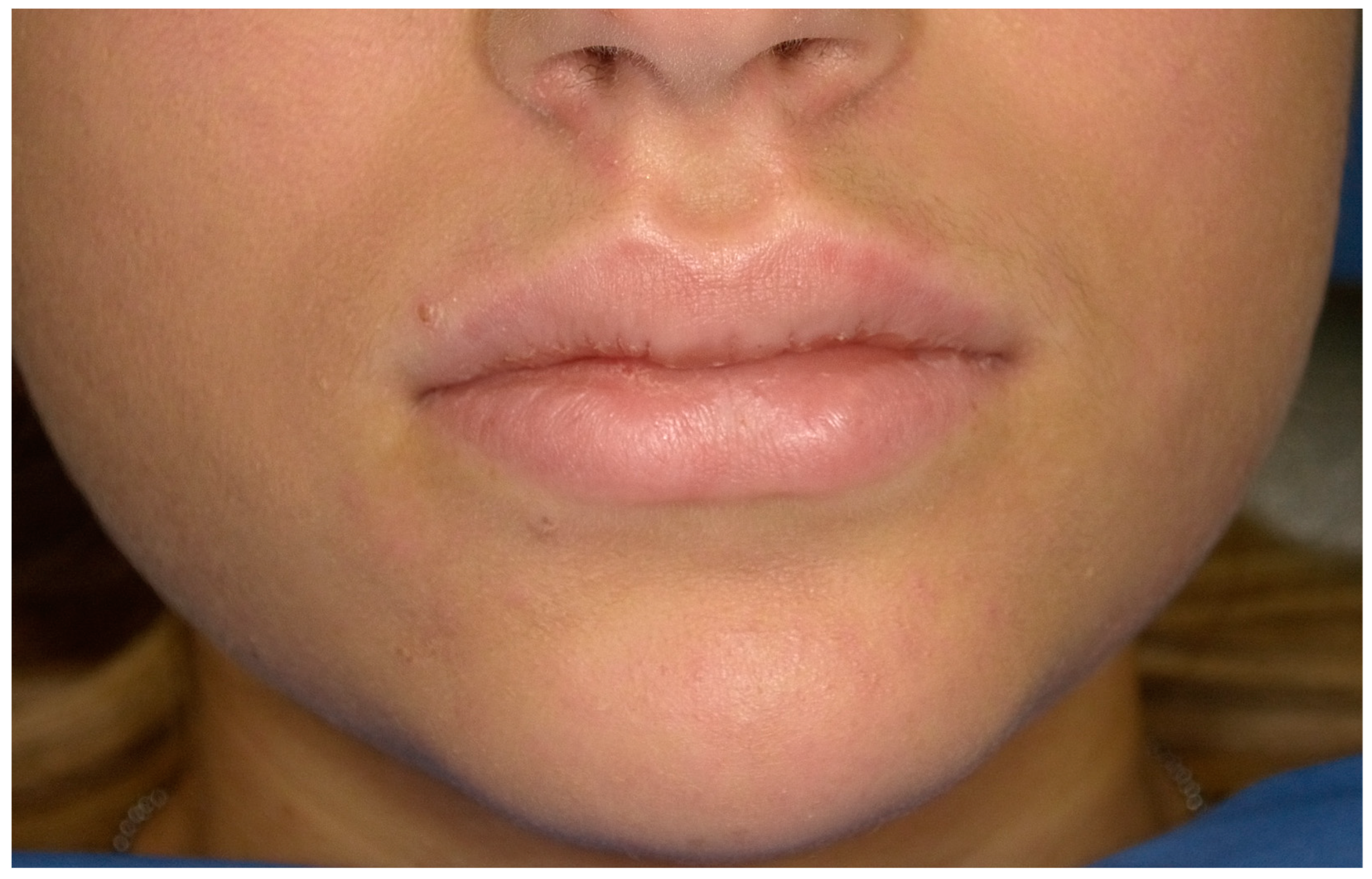 Children 11 01019 g002