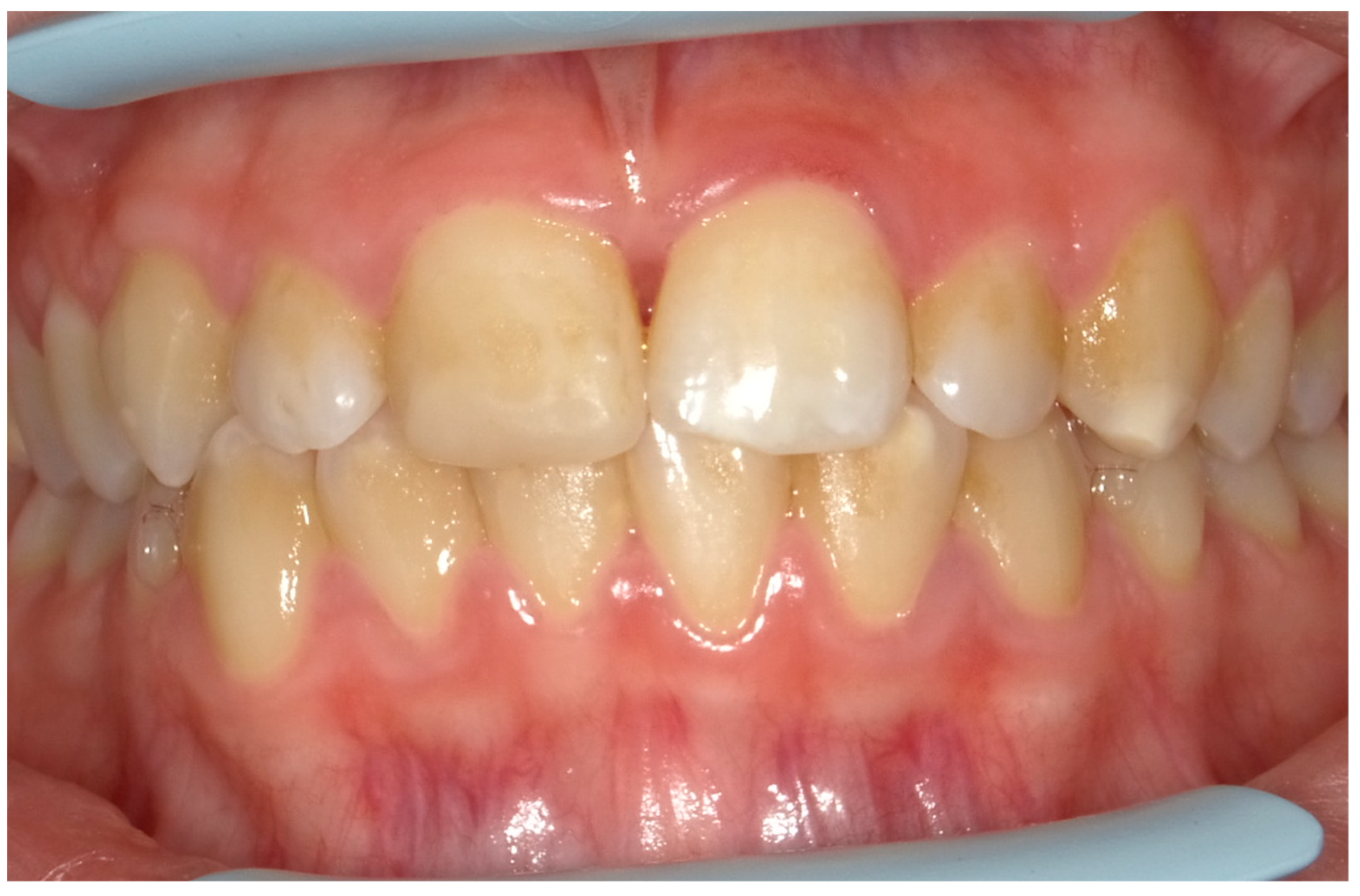 Children 11 01019 g004