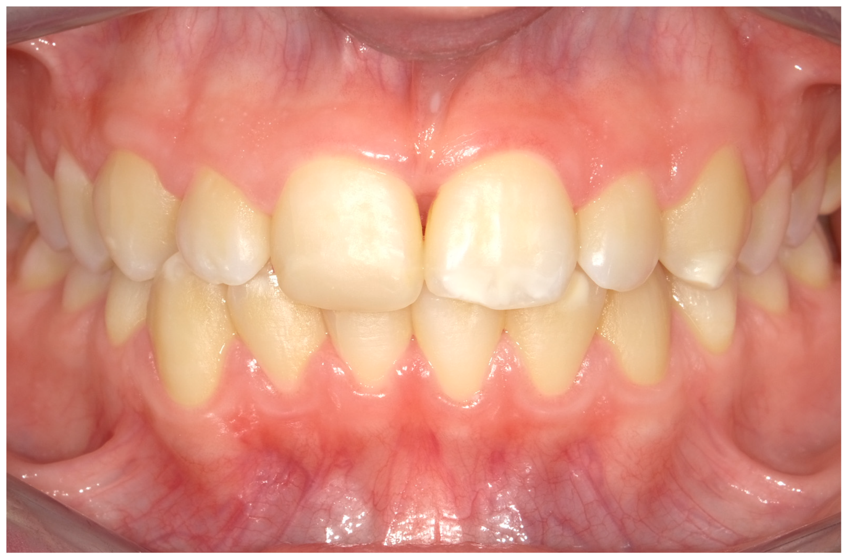 Children 11 01019 g005