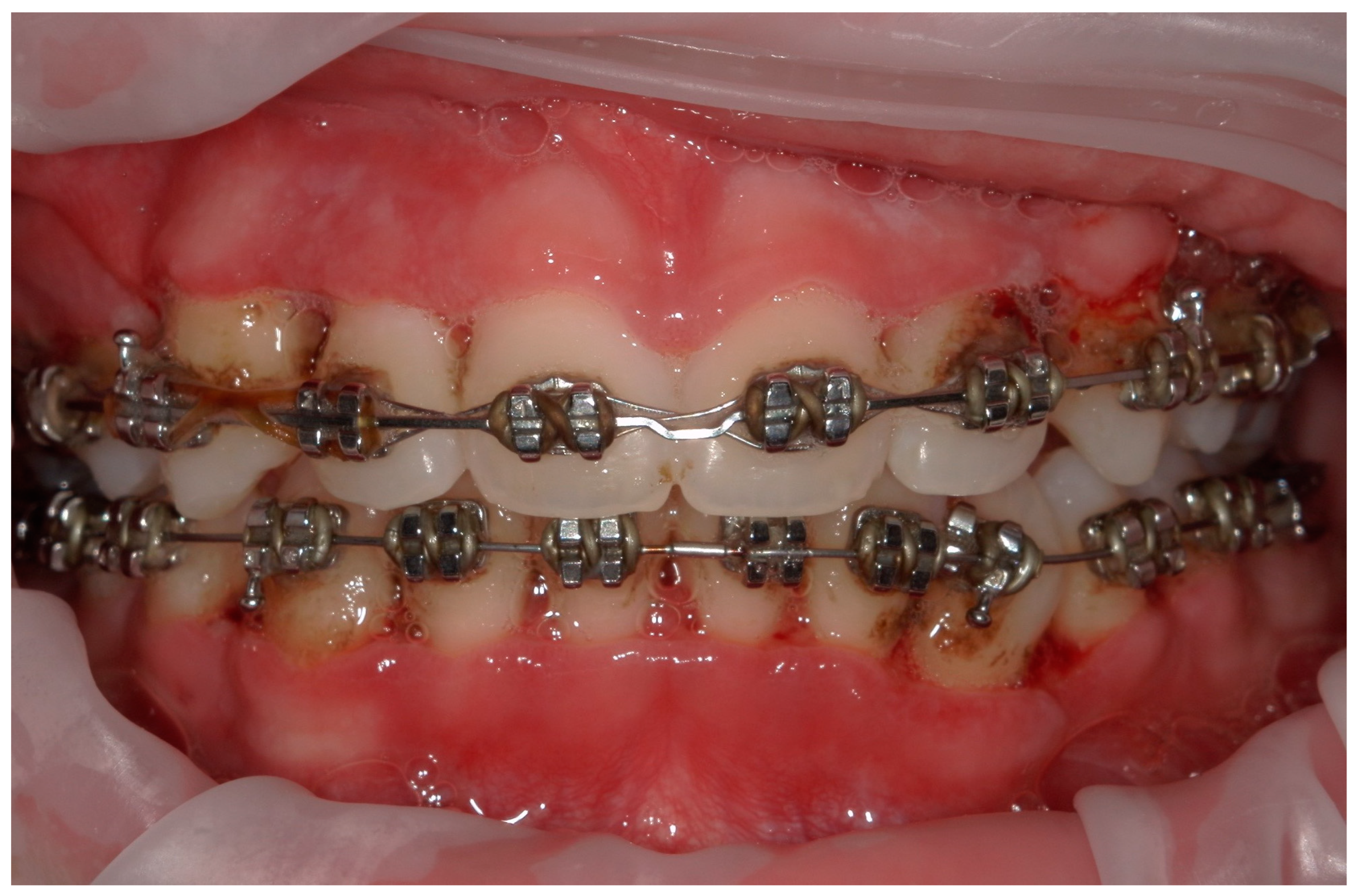 Children 11 01019 g007