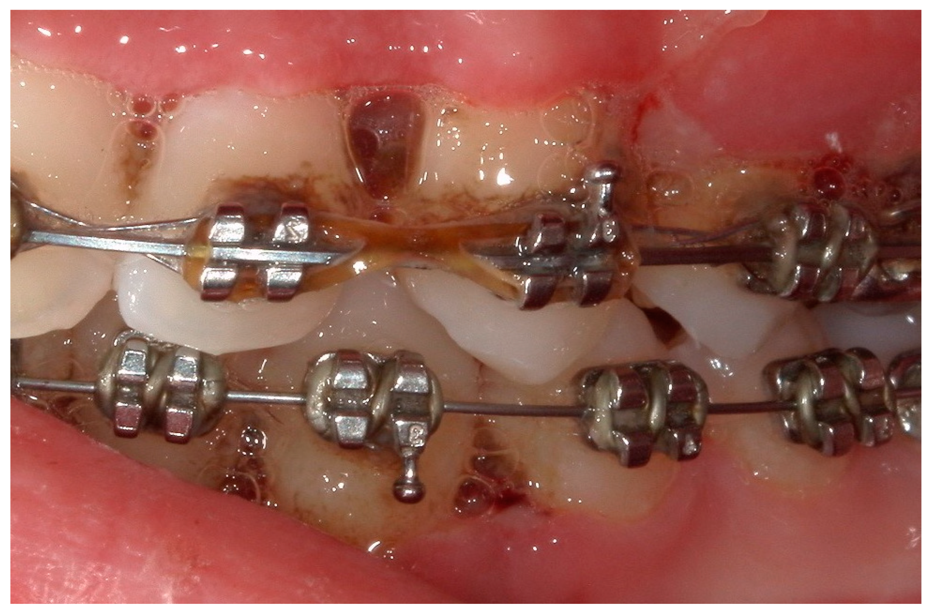 Children 11 01019 g008